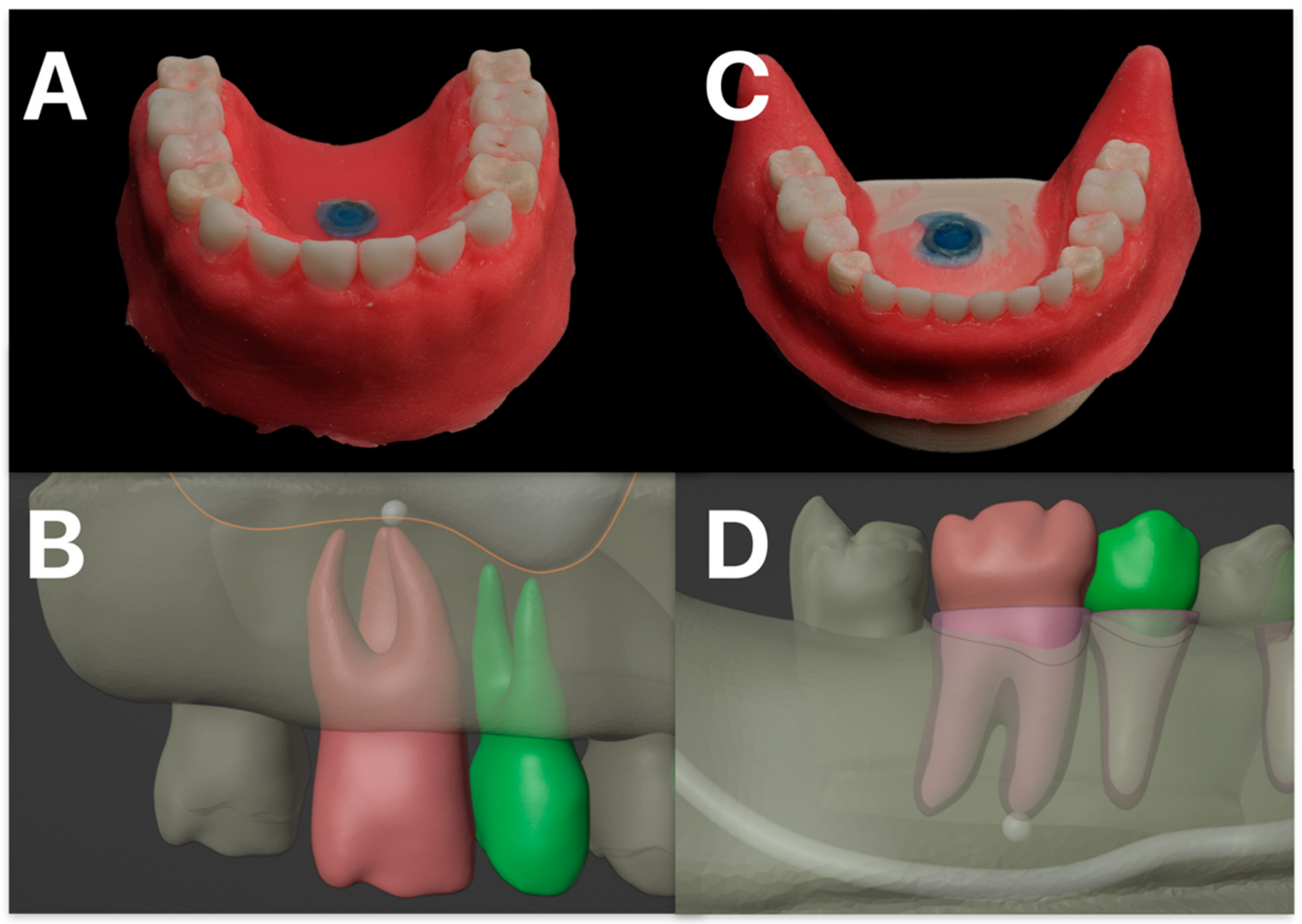 Dentistry 13 00464 g001