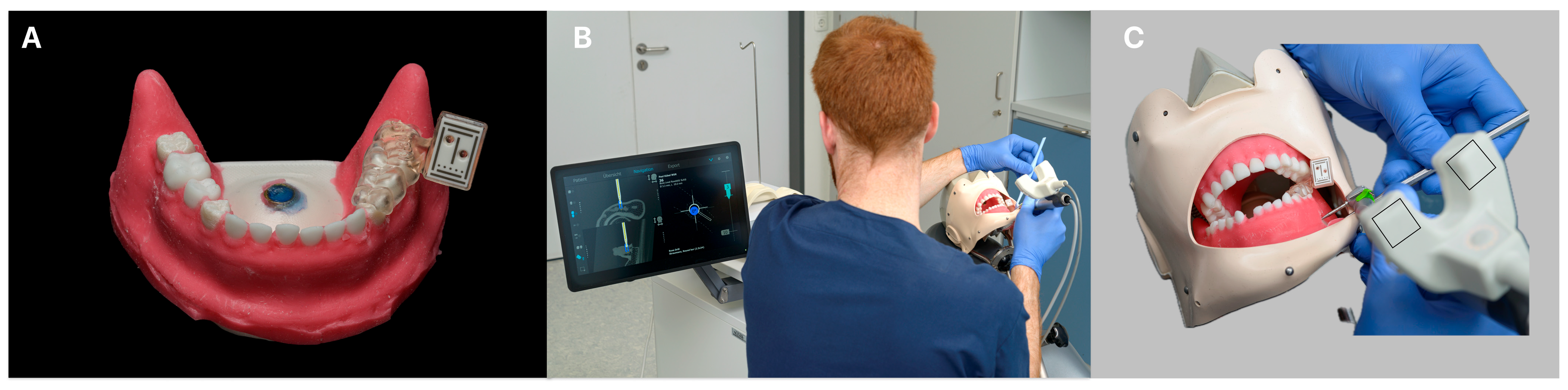 Dentistry 13 00464 g003