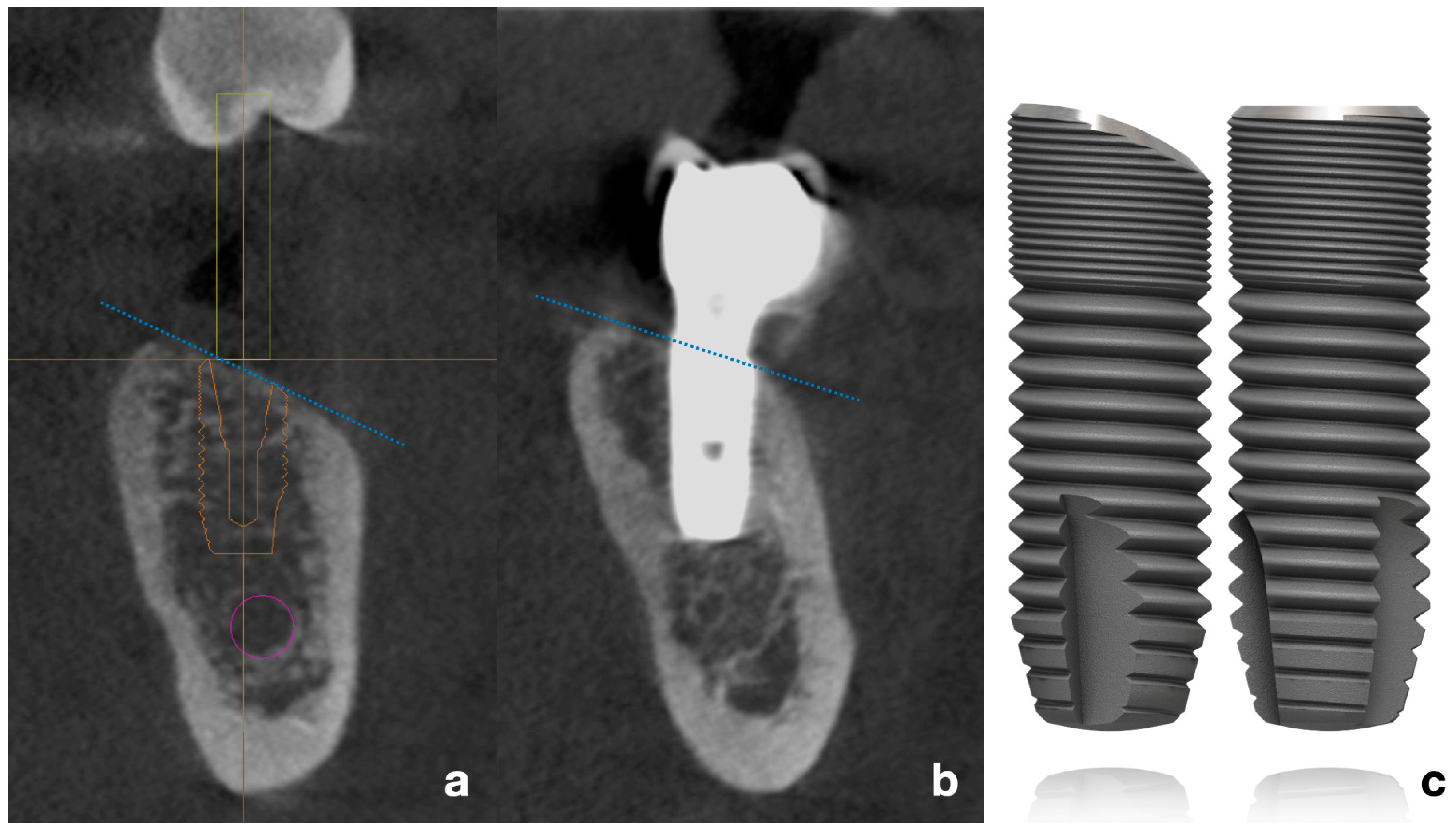 Dentistry 13 00466 g001