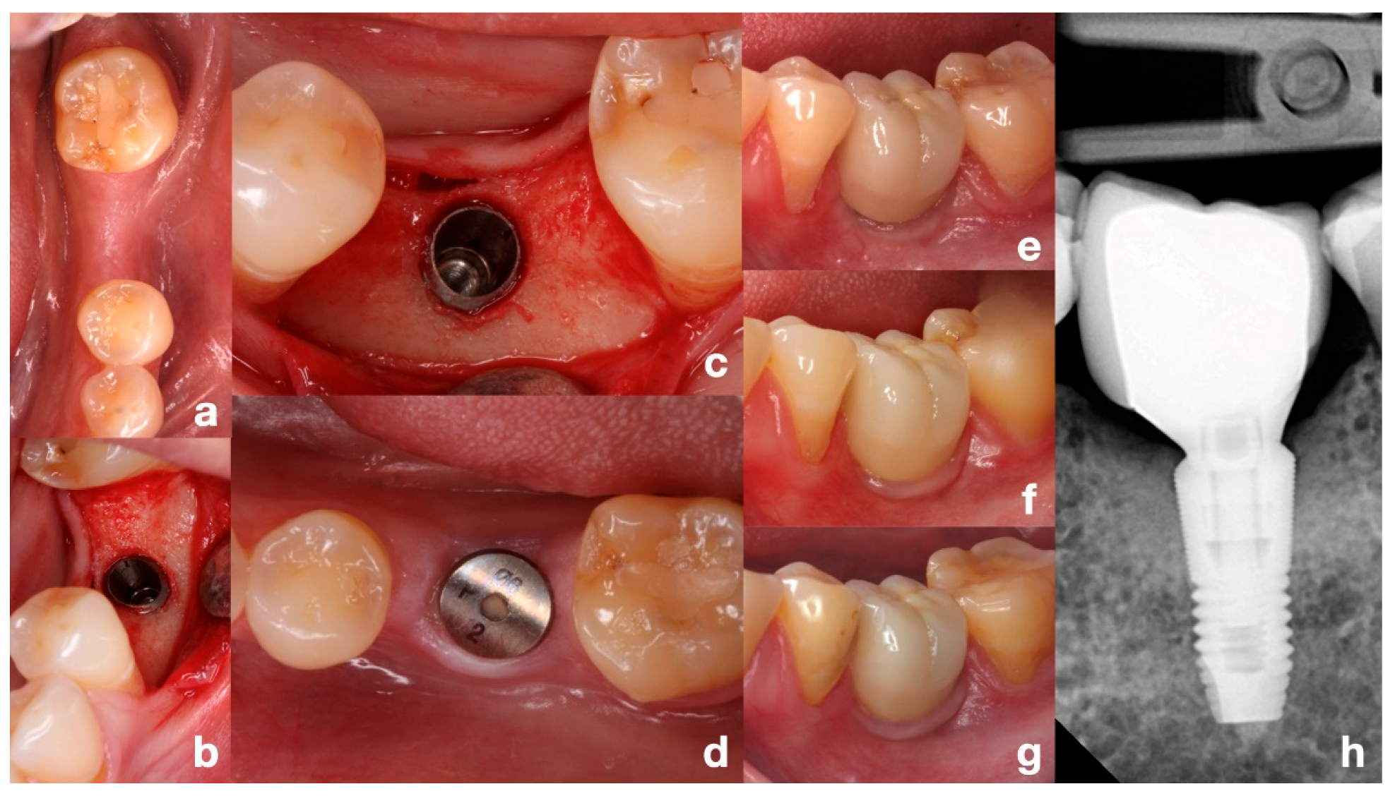 Dentistry 13 00466 g002