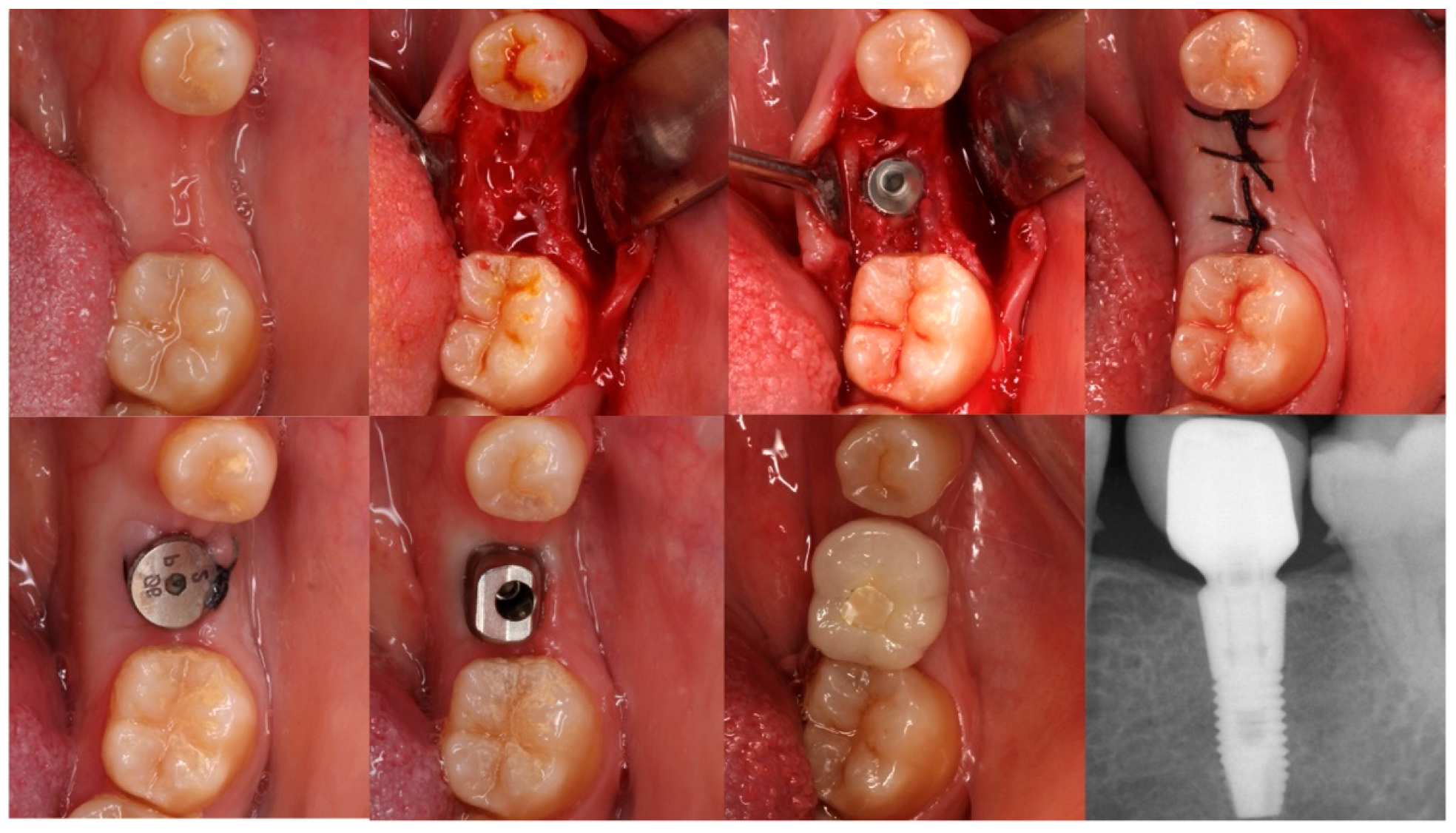 Dentistry 13 00466 g003