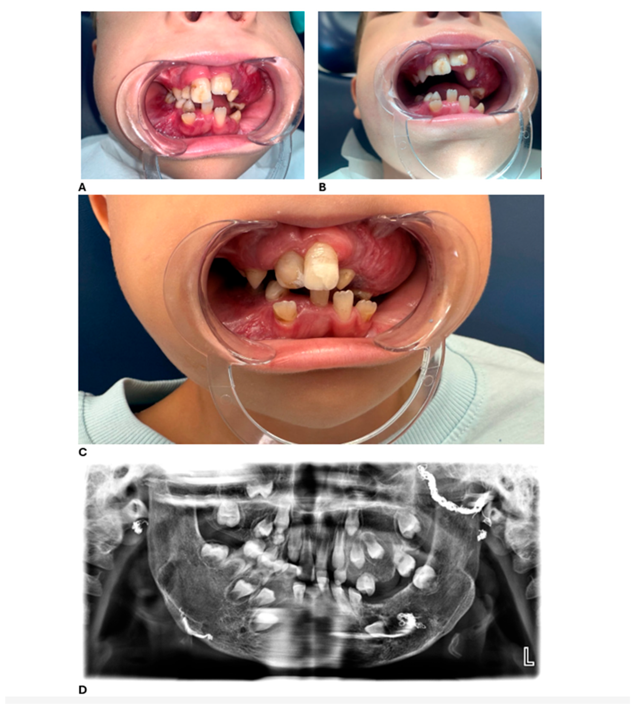 Dentistry 13 00473 g003
