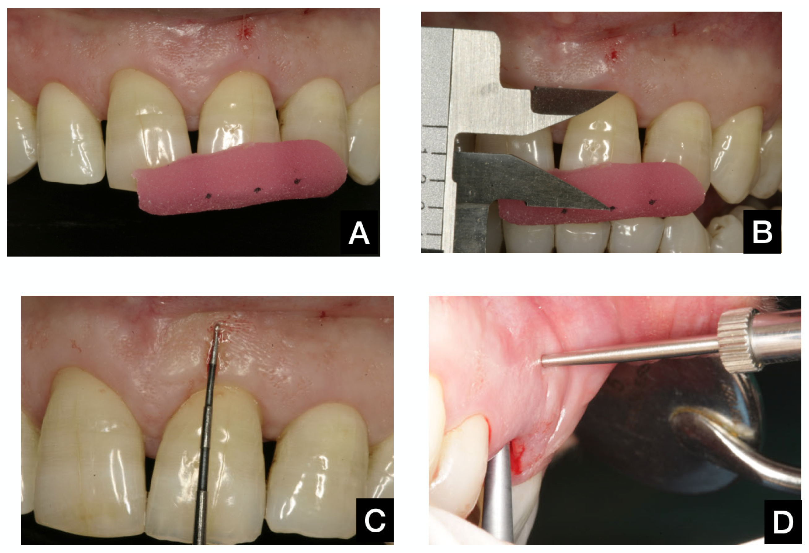 Dentistry 13 00478 g002 Dentistry 13 00478 g002