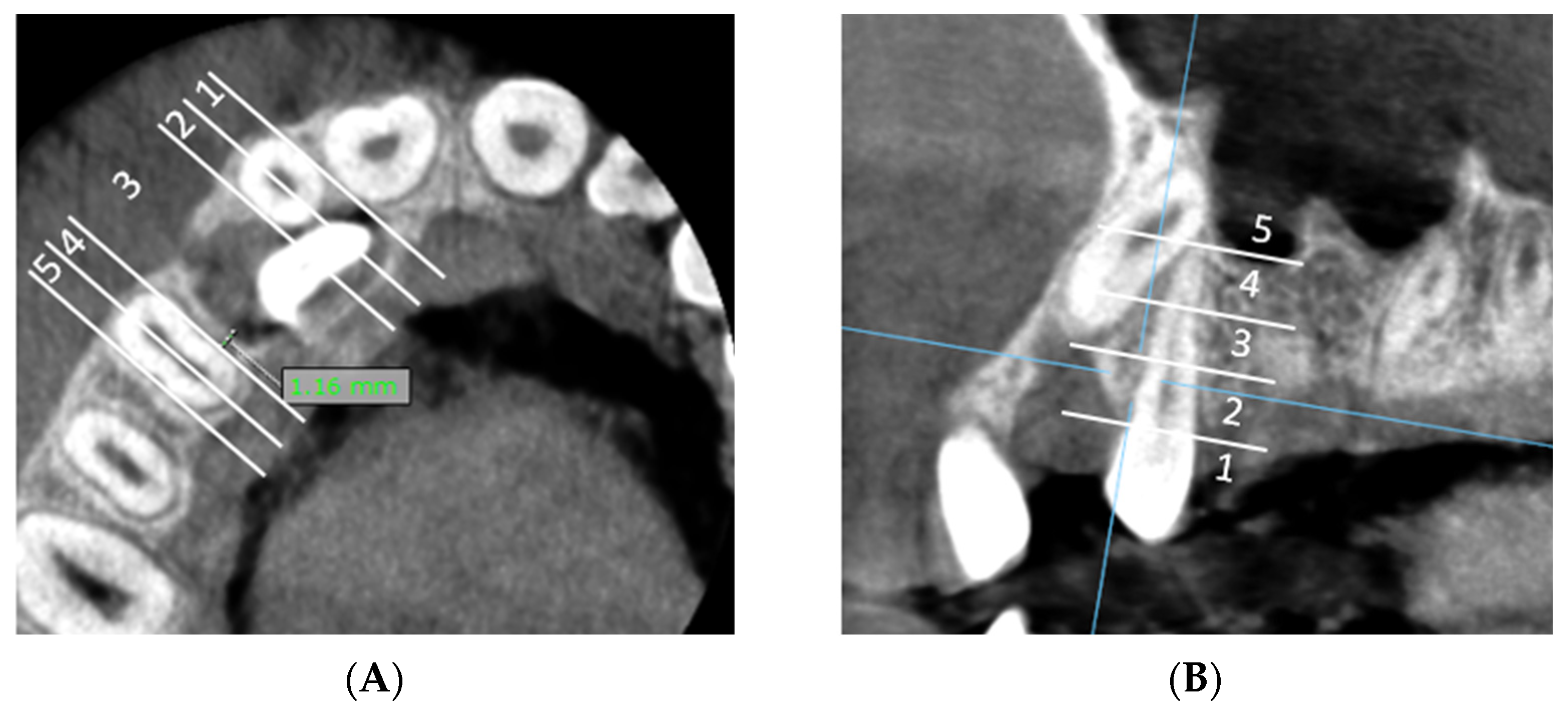 Dentistry 13 00497 g003
