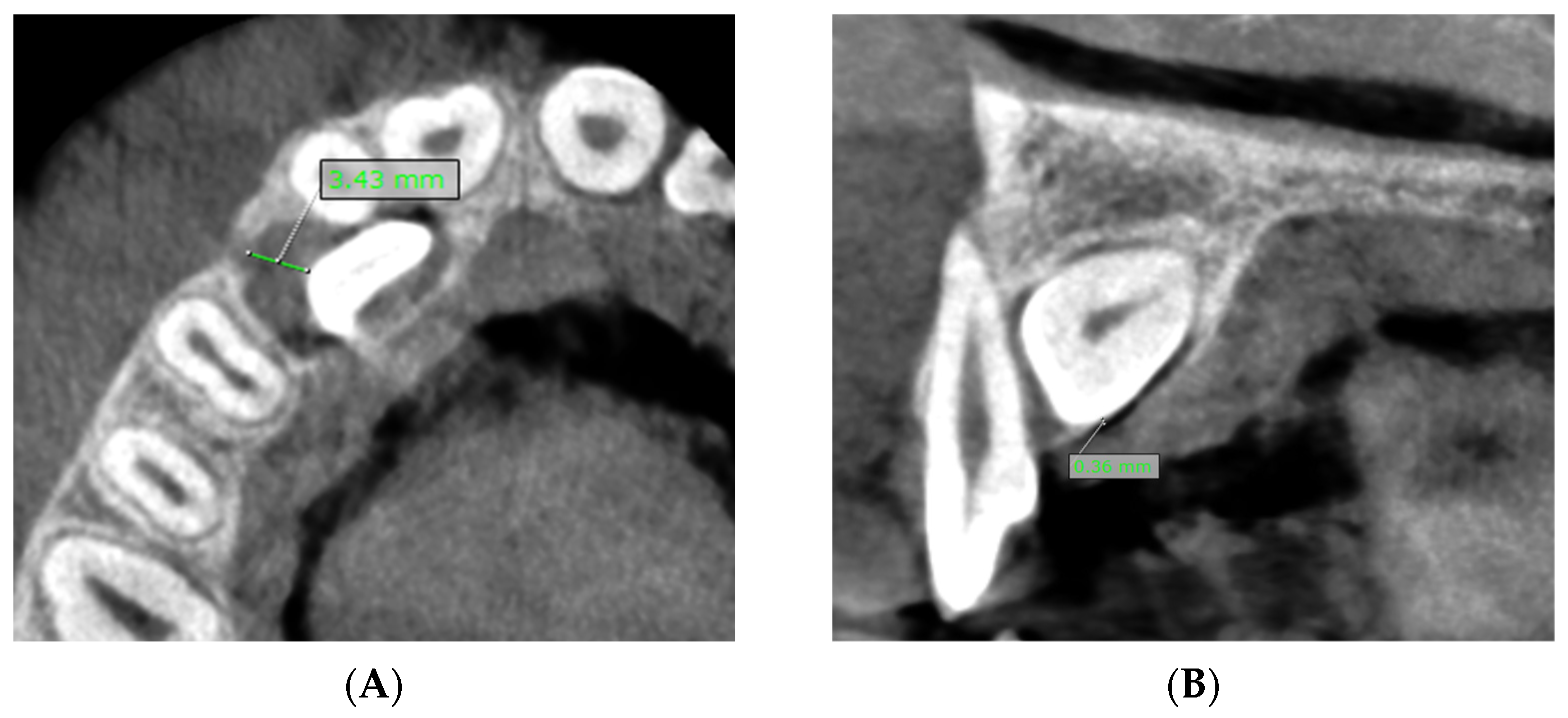 Dentistry 13 00497 g004