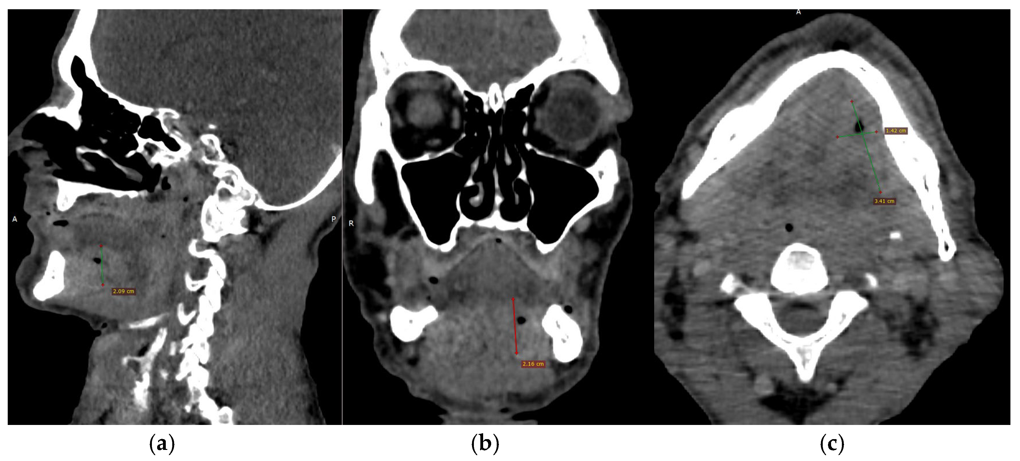 Dentistry 13 00499 g003