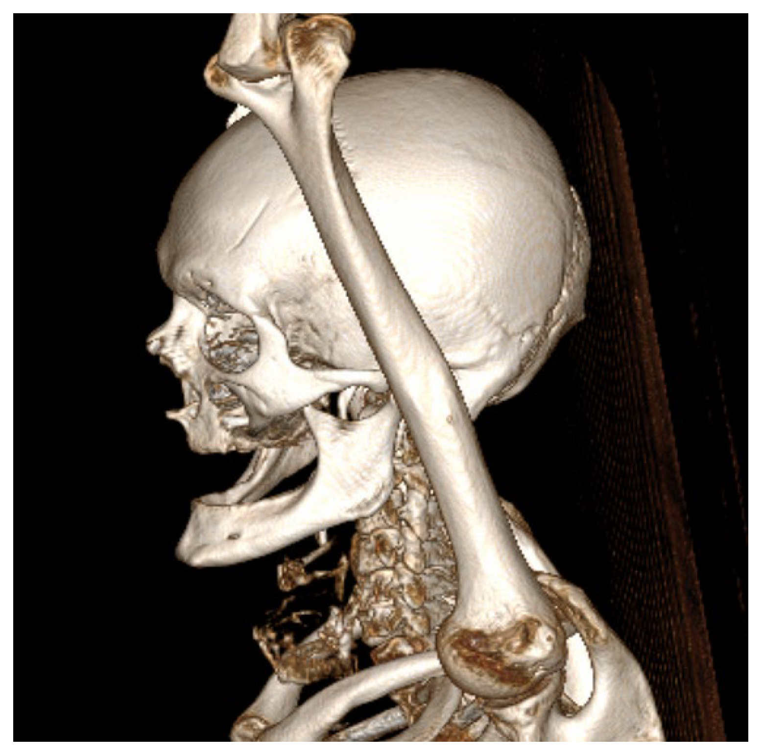 Dentistry 13 00499 g004