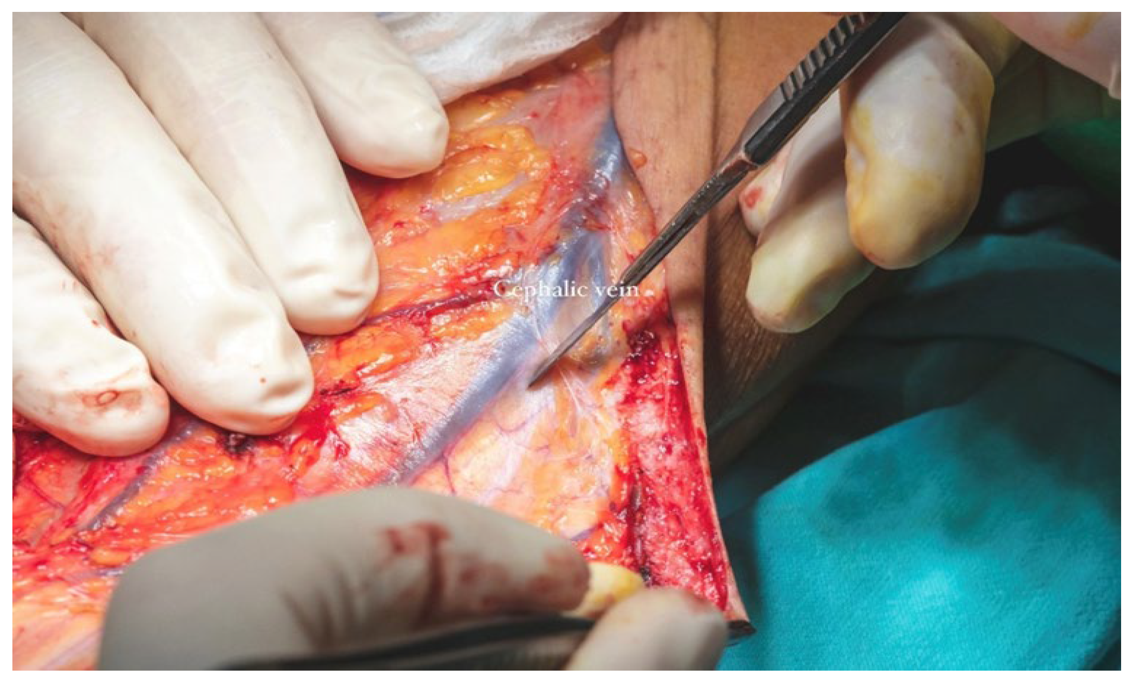 Dentistry 13 00499 g014