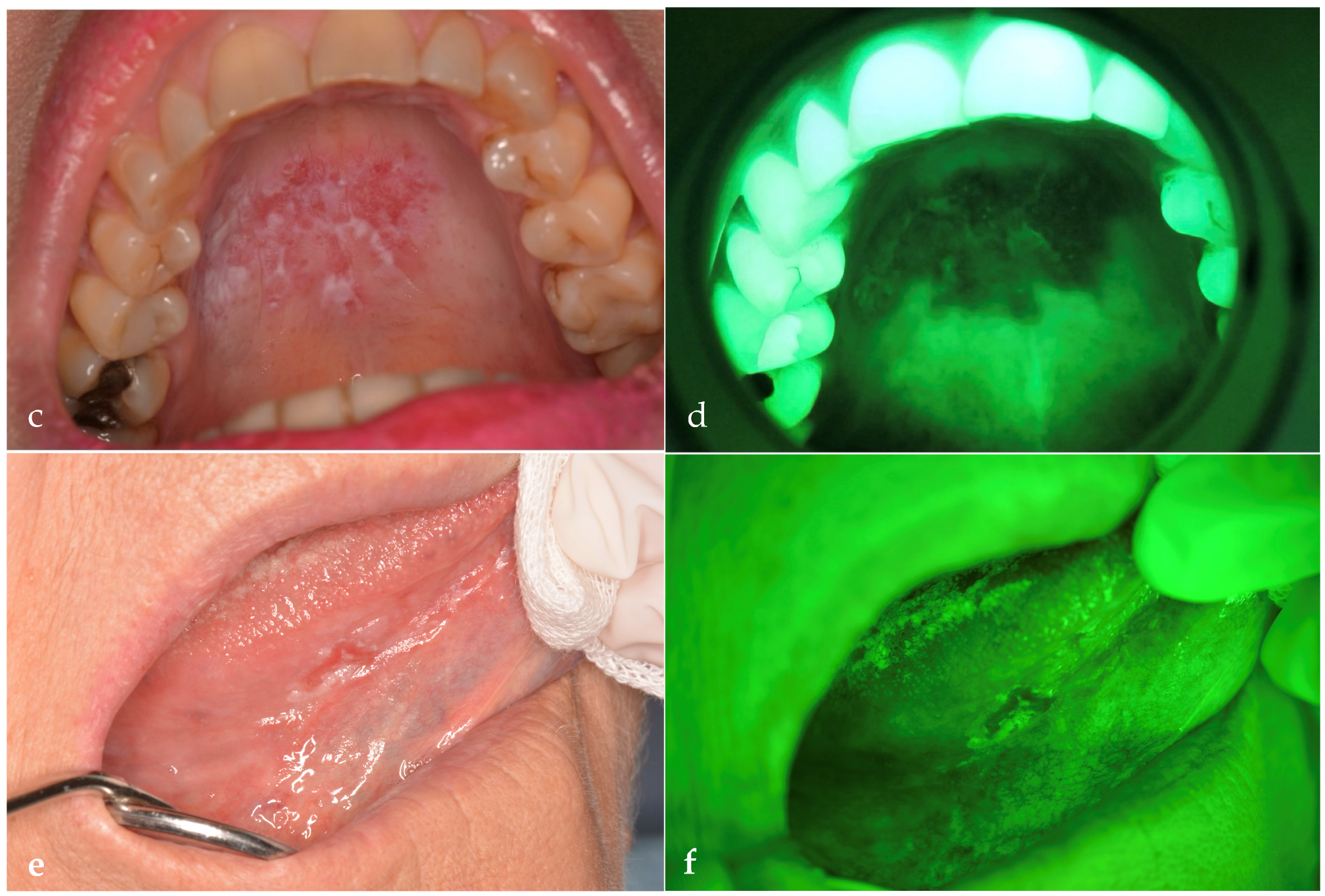 Dentistry 13 00512 g001b Dentistry 13 00512 g001b