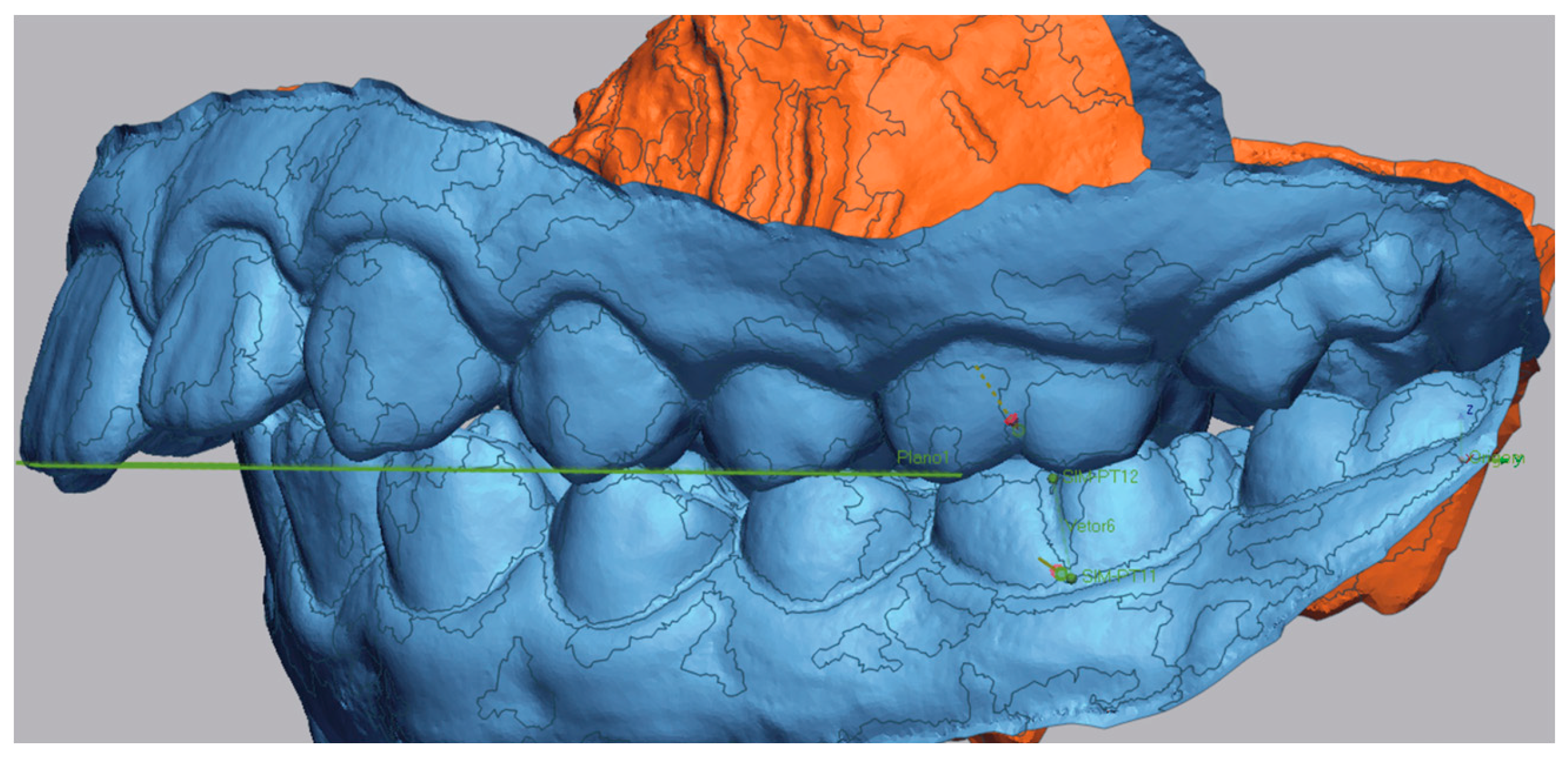 Dentistry 13 00517 g004