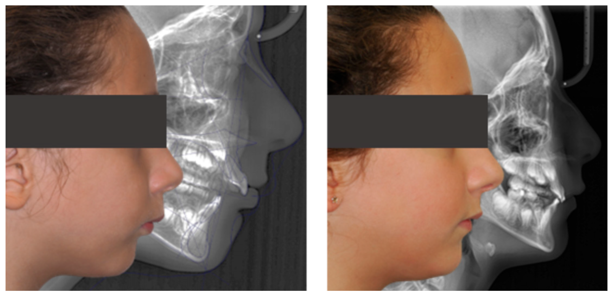 Dentistry 13 00517 g008