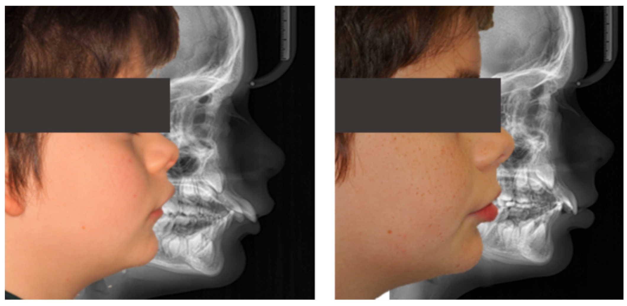 Dentistry 13 00517 g011