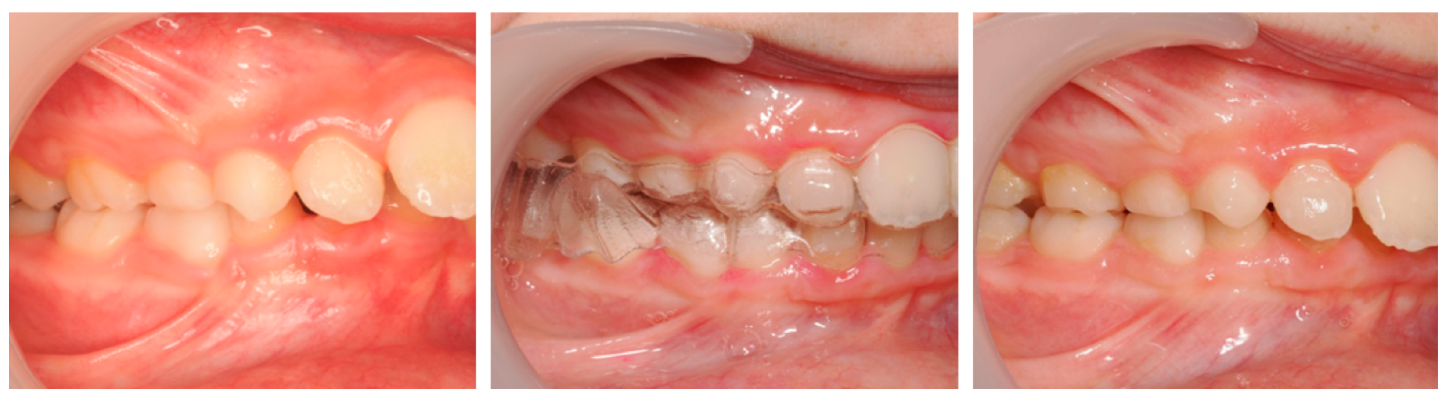 Dentistry 13 00517 g012