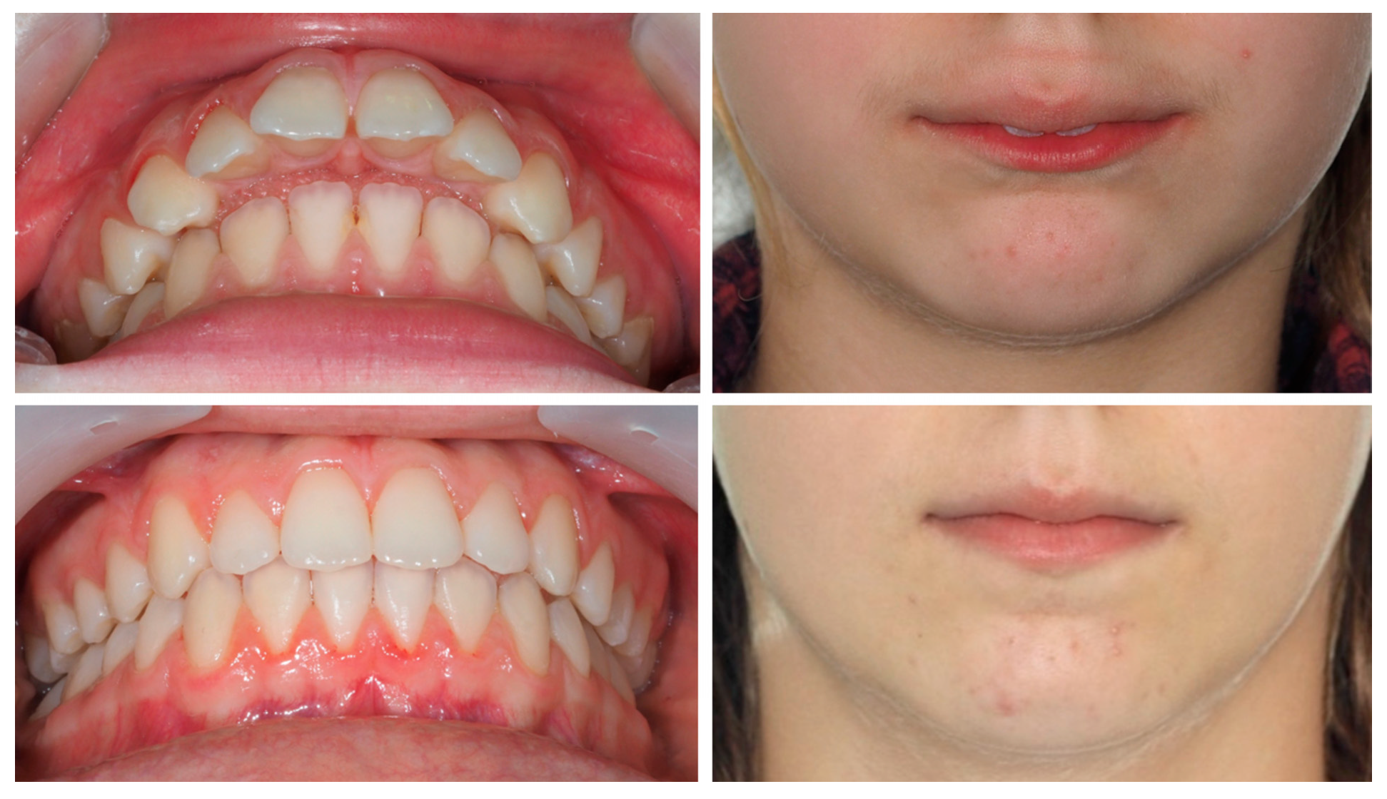 Dentistry 13 00517 g013