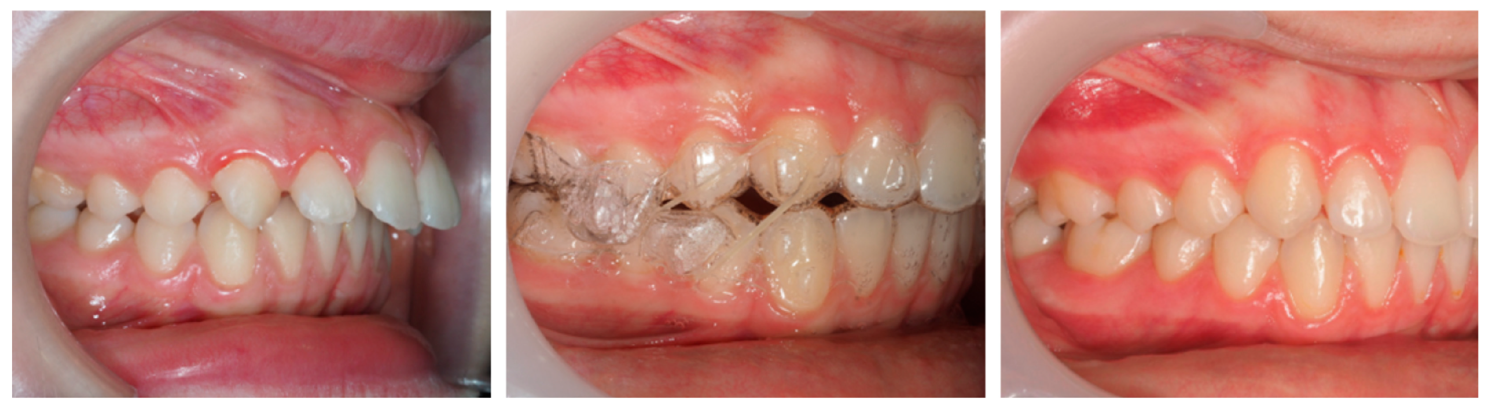 Dentistry 13 00517 g015