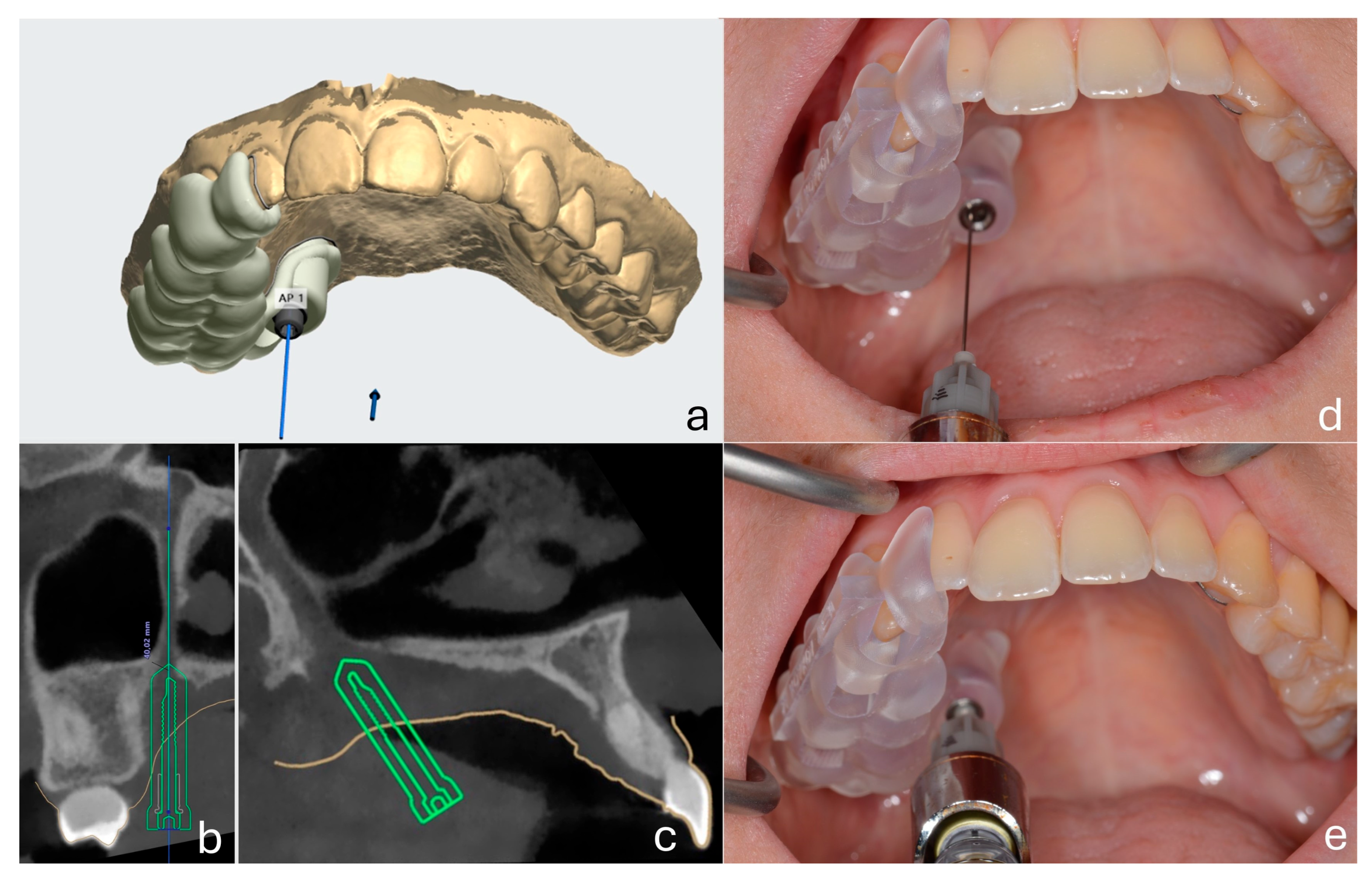 Dentistry 13 00521 g001