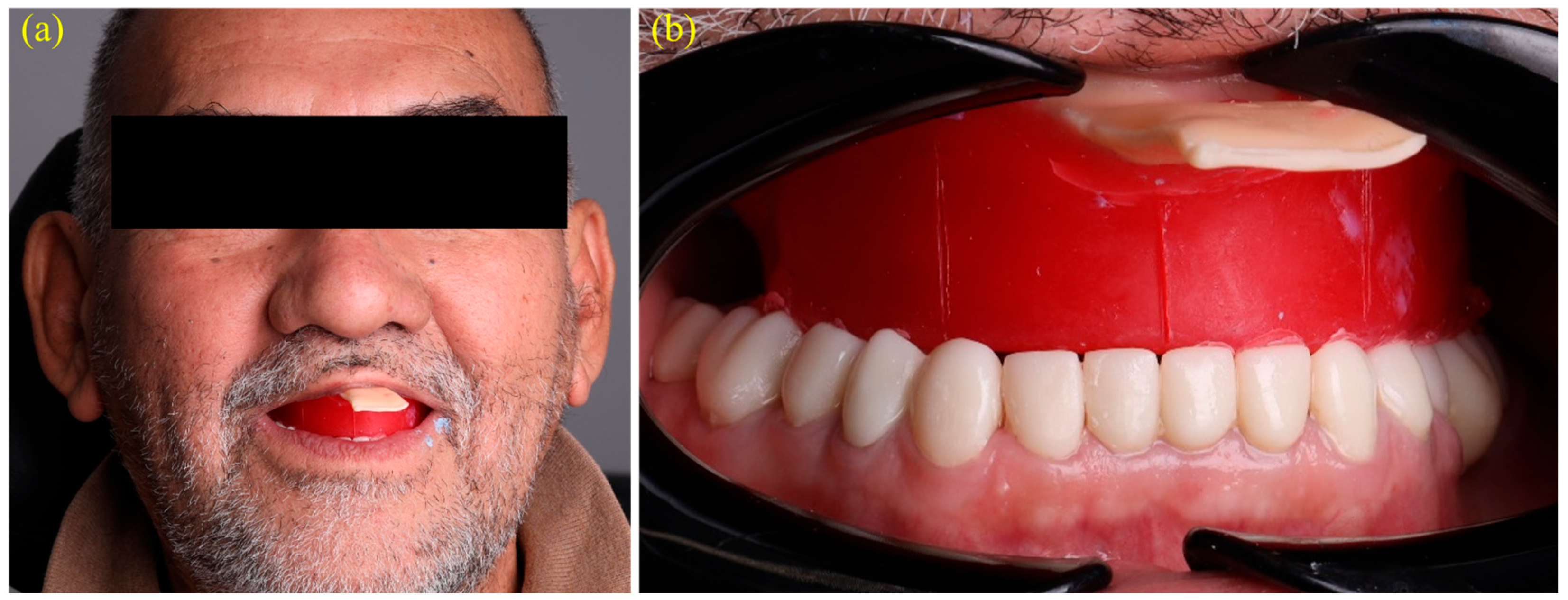 Dentistry 13 00524 g004