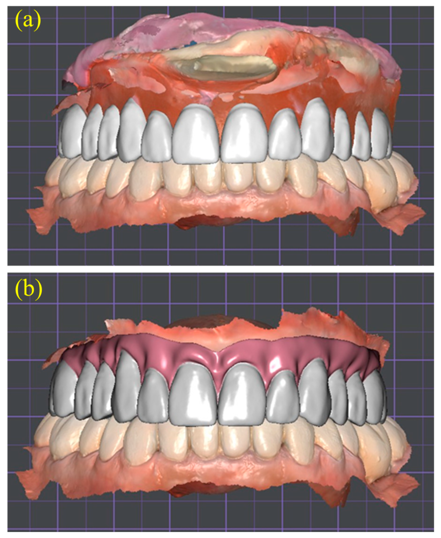 Dentistry 13 00524 g006