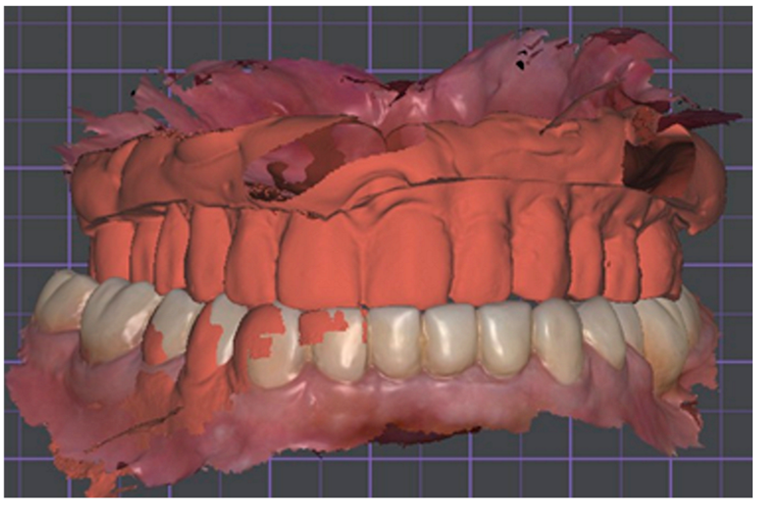 Dentistry 13 00524 g008