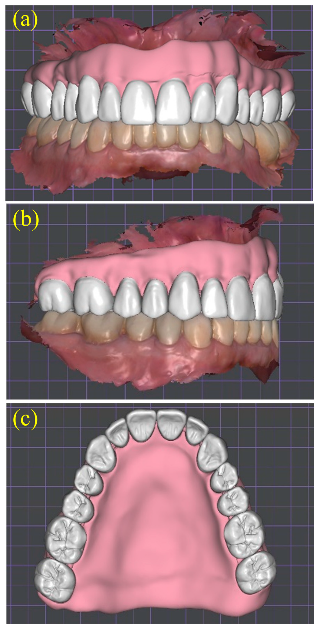 Dentistry 13 00524 g010