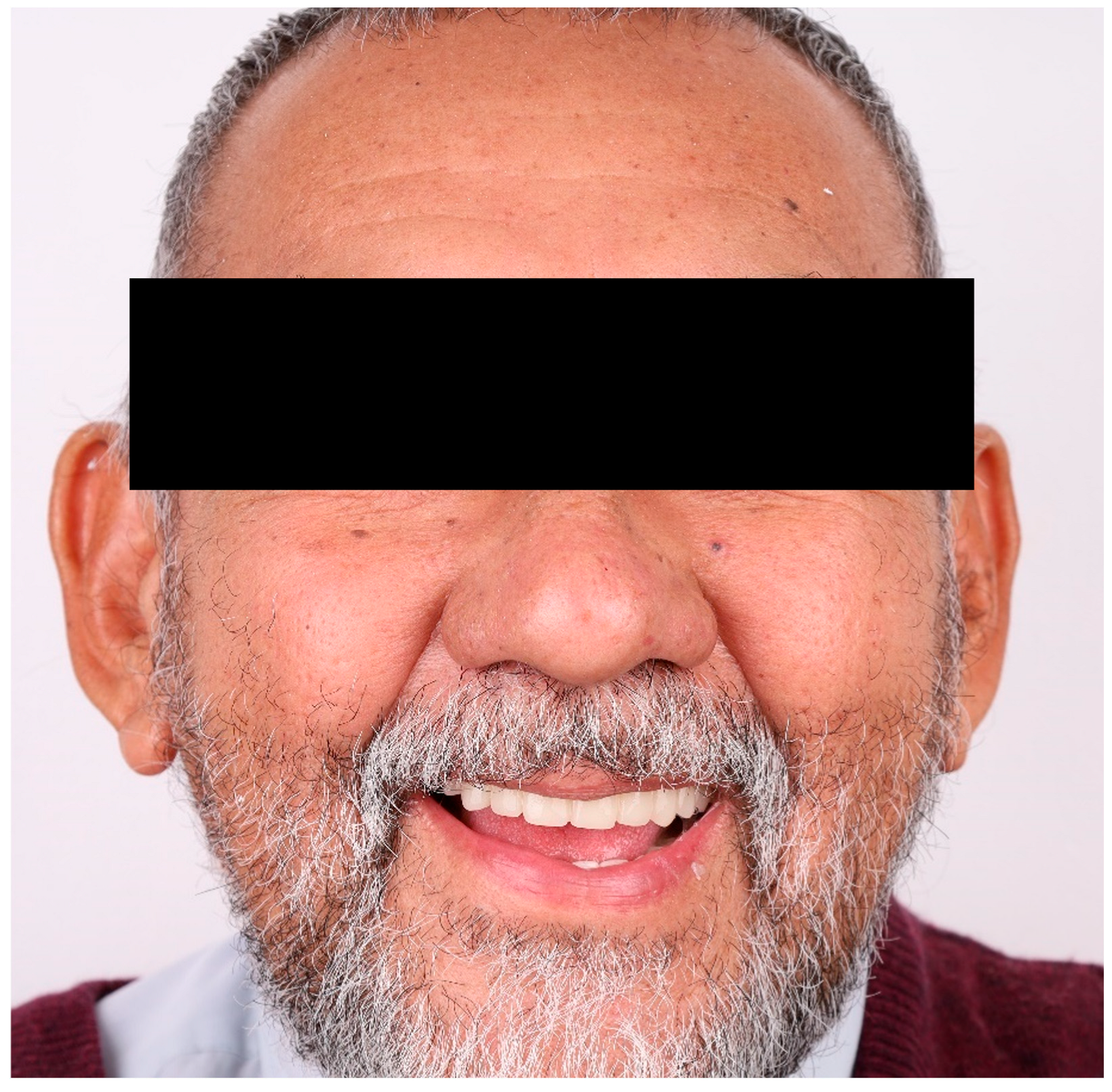 Dentistry 13 00524 g012