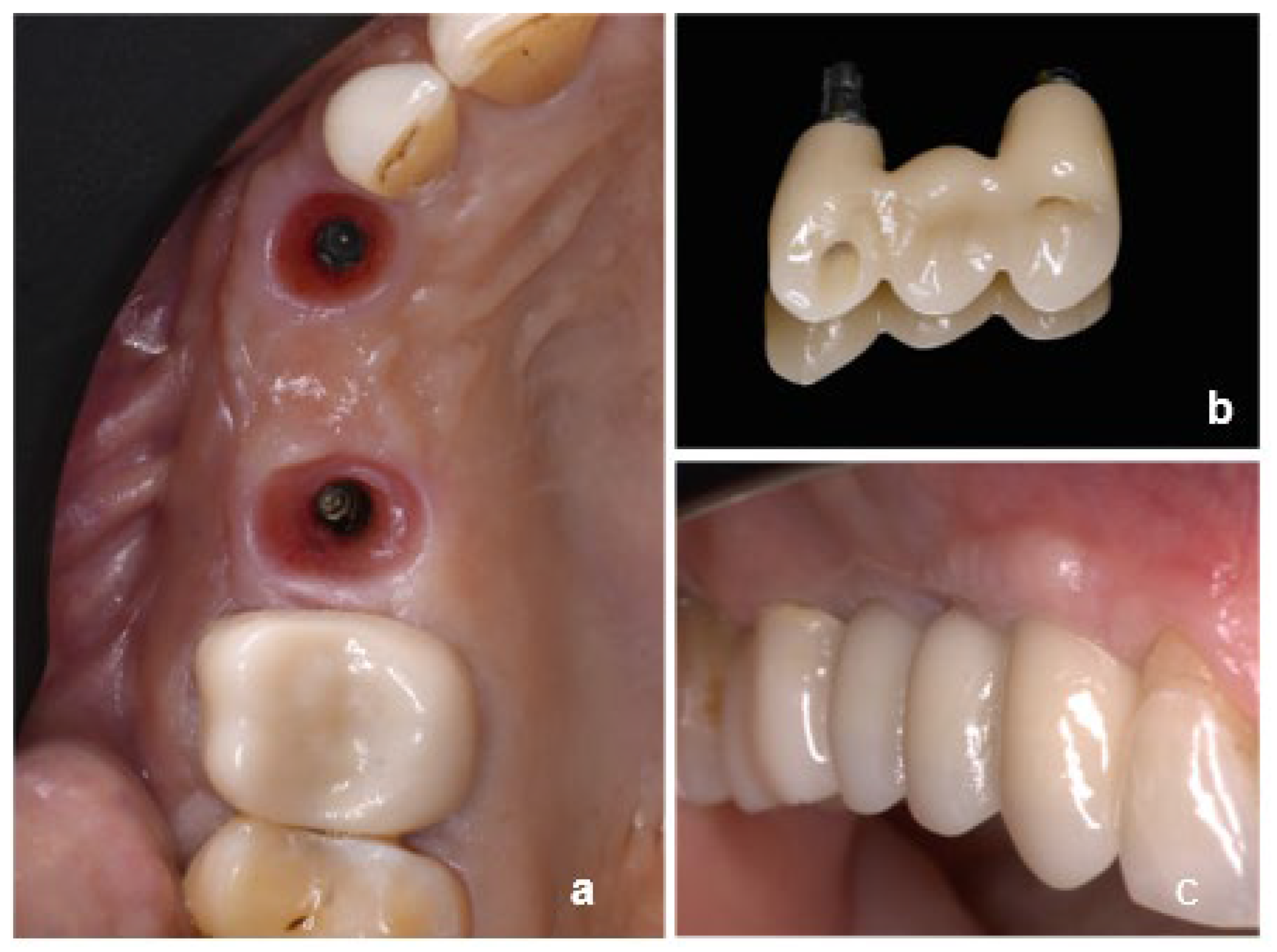 Dentistry 13 00525 g001