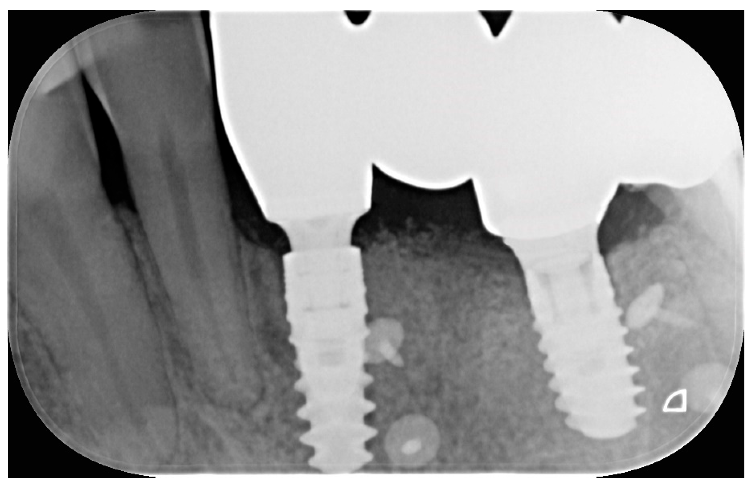 Dentistry 13 00525 g005