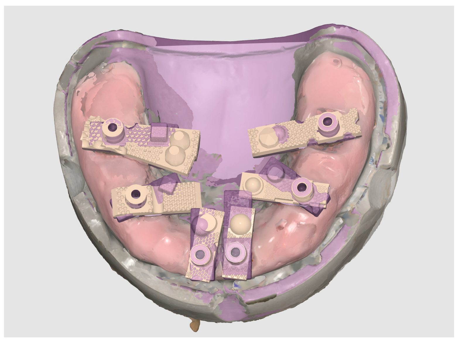 Dentistry 13 00533 g004 Dentistry 13 00533 g004