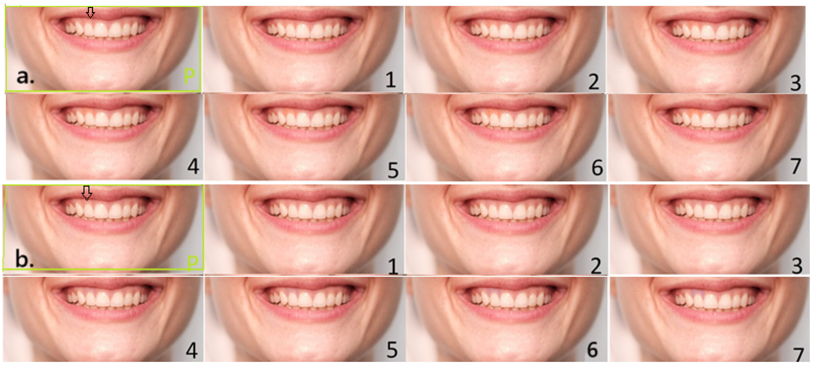 Dentistry 13 00534 g002