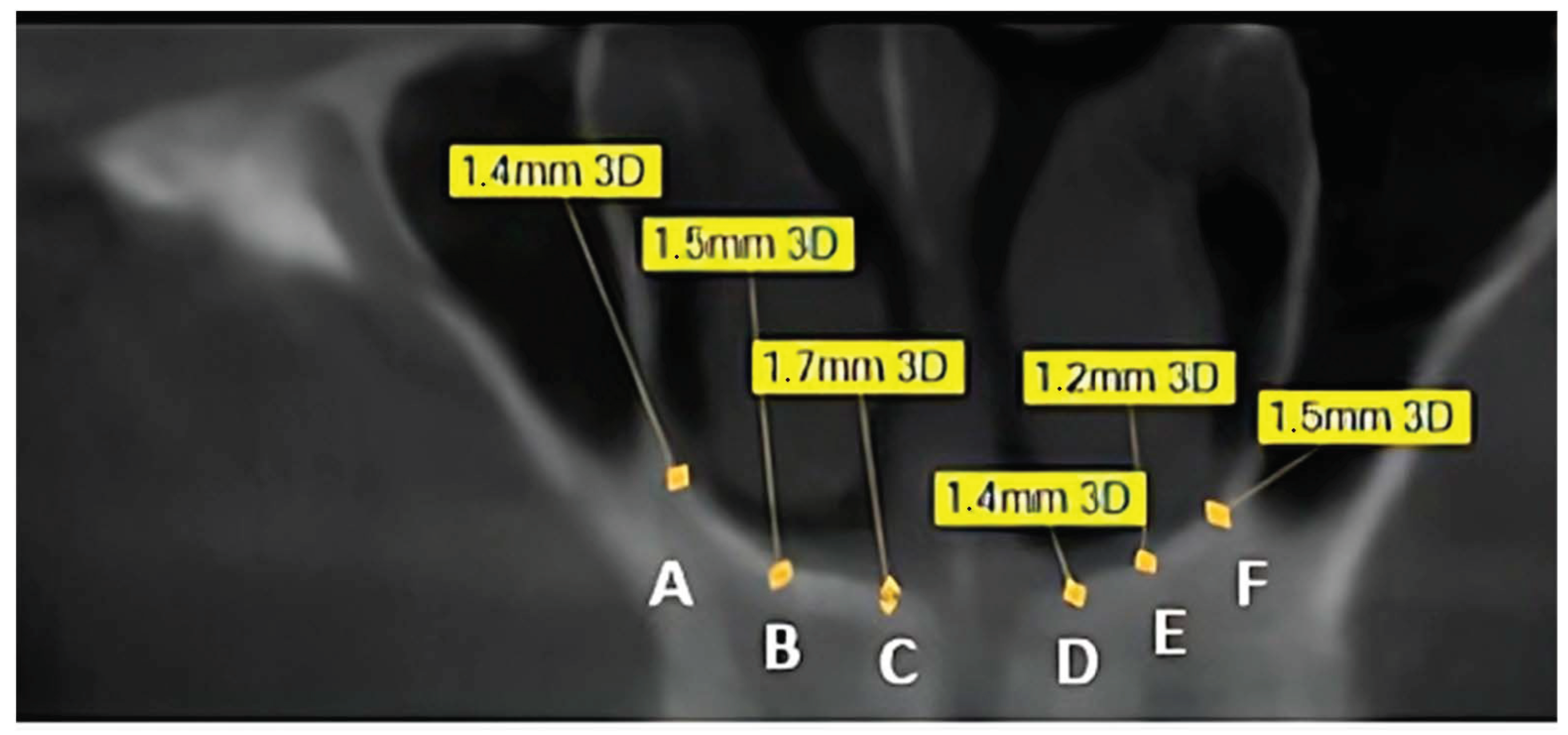 Dentistry 13 00539 g001
