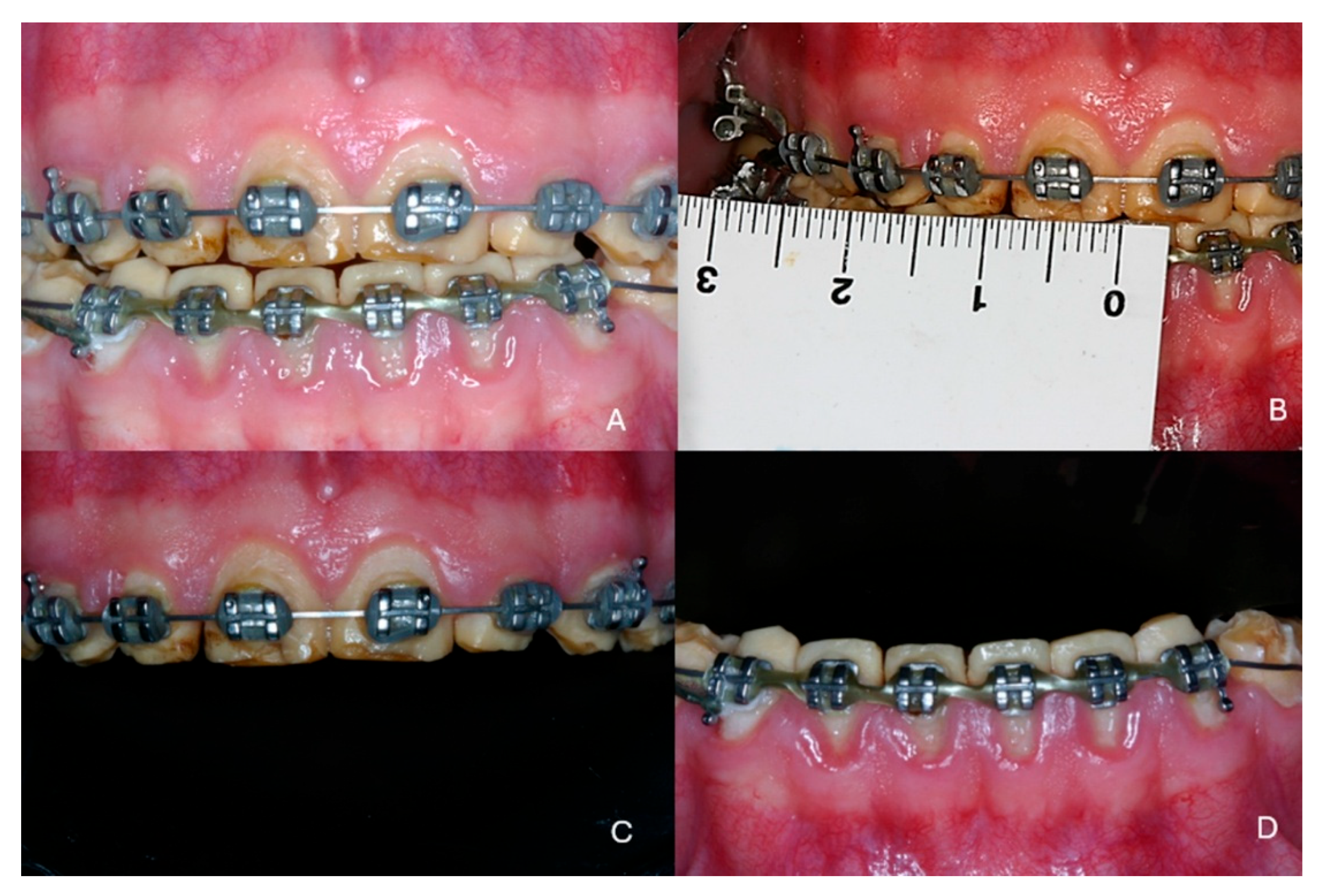 Dentistry 13 00546 g001