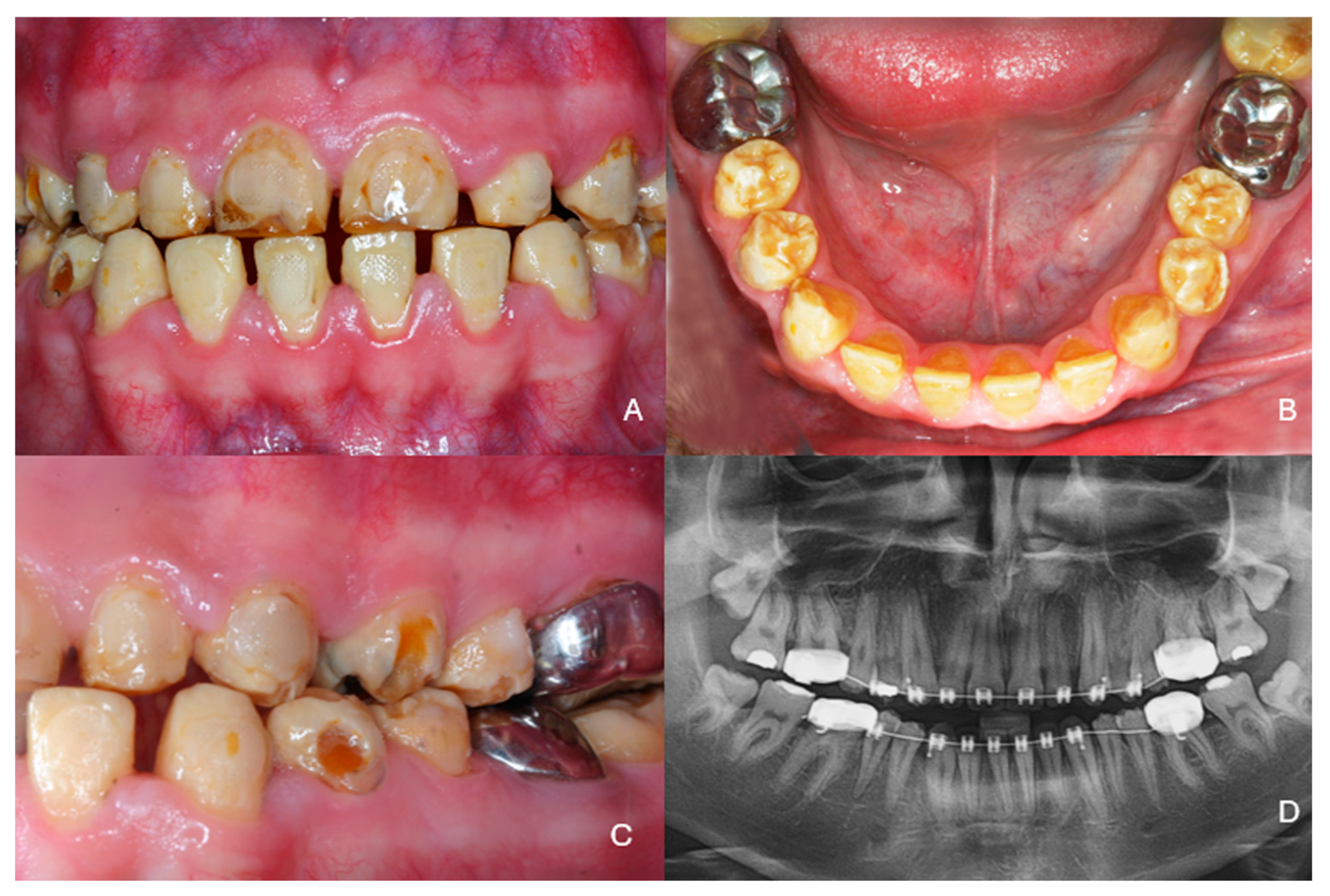 Dentistry 13 00546 g002