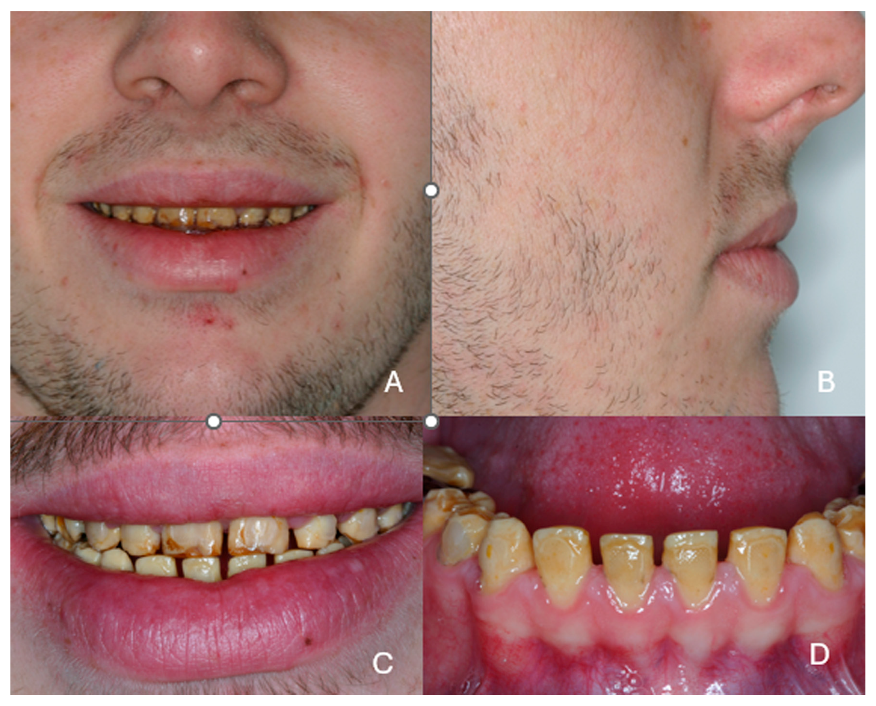 Dentistry 13 00546 g003