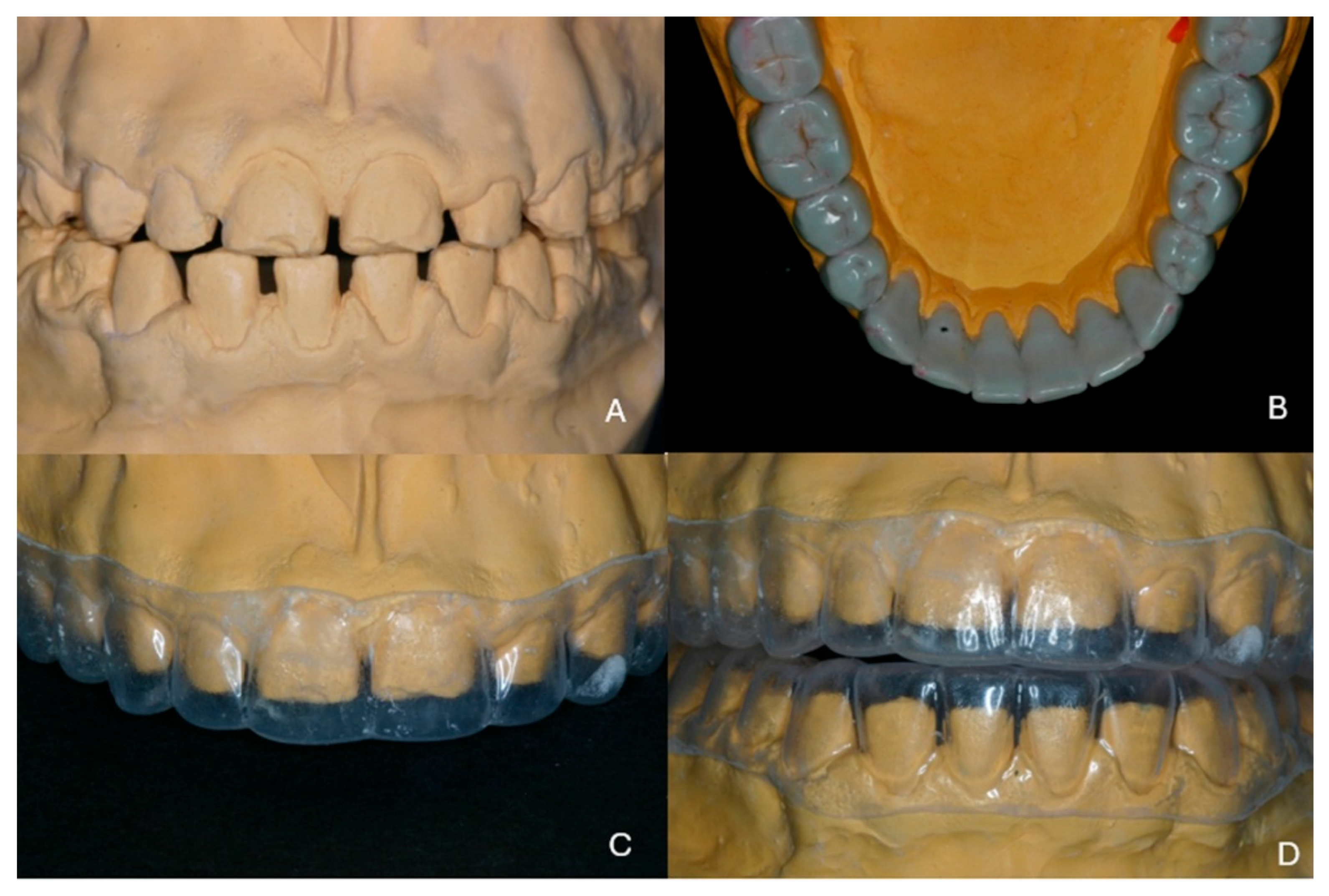 Dentistry 13 00546 g004