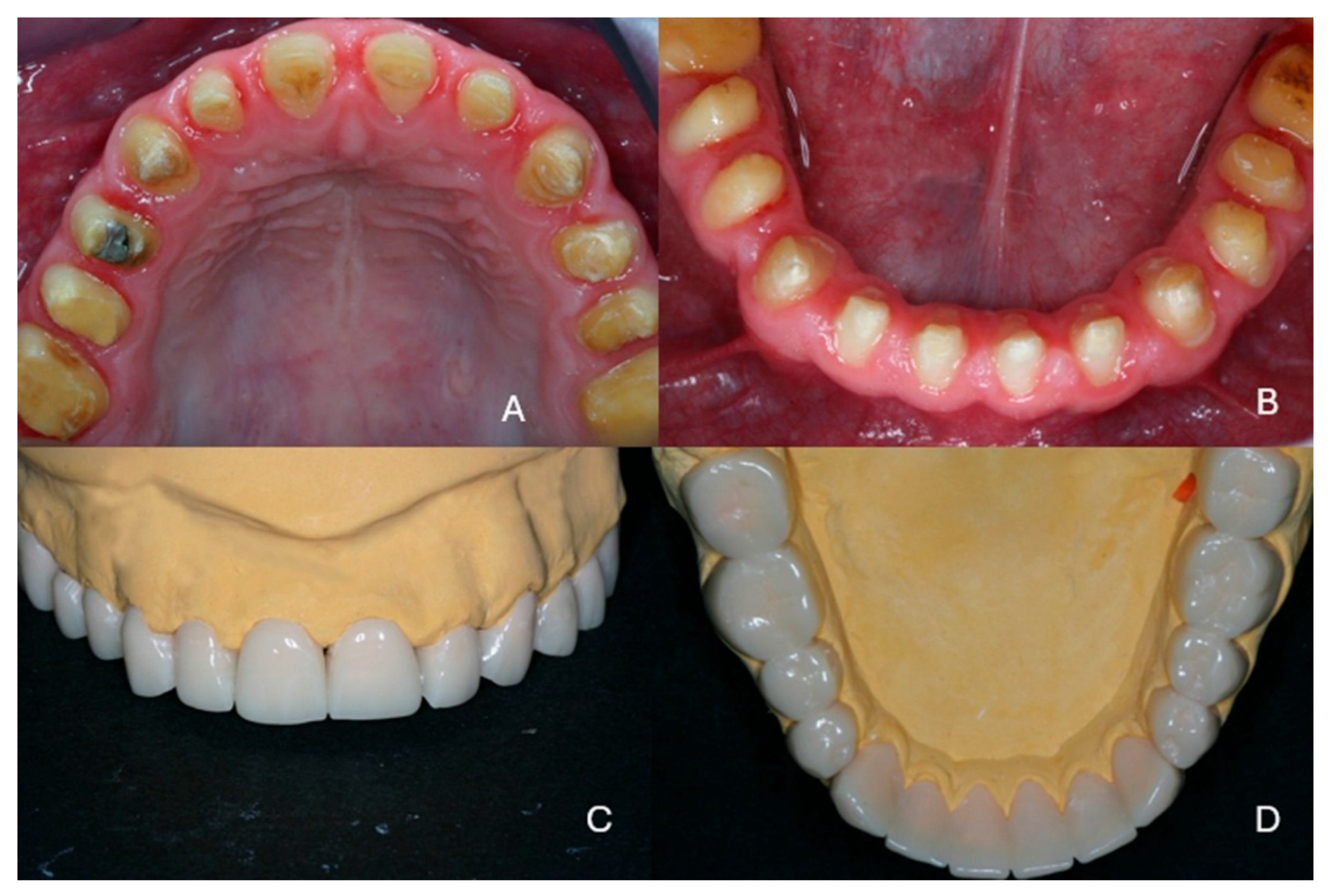 Dentistry 13 00546 g005