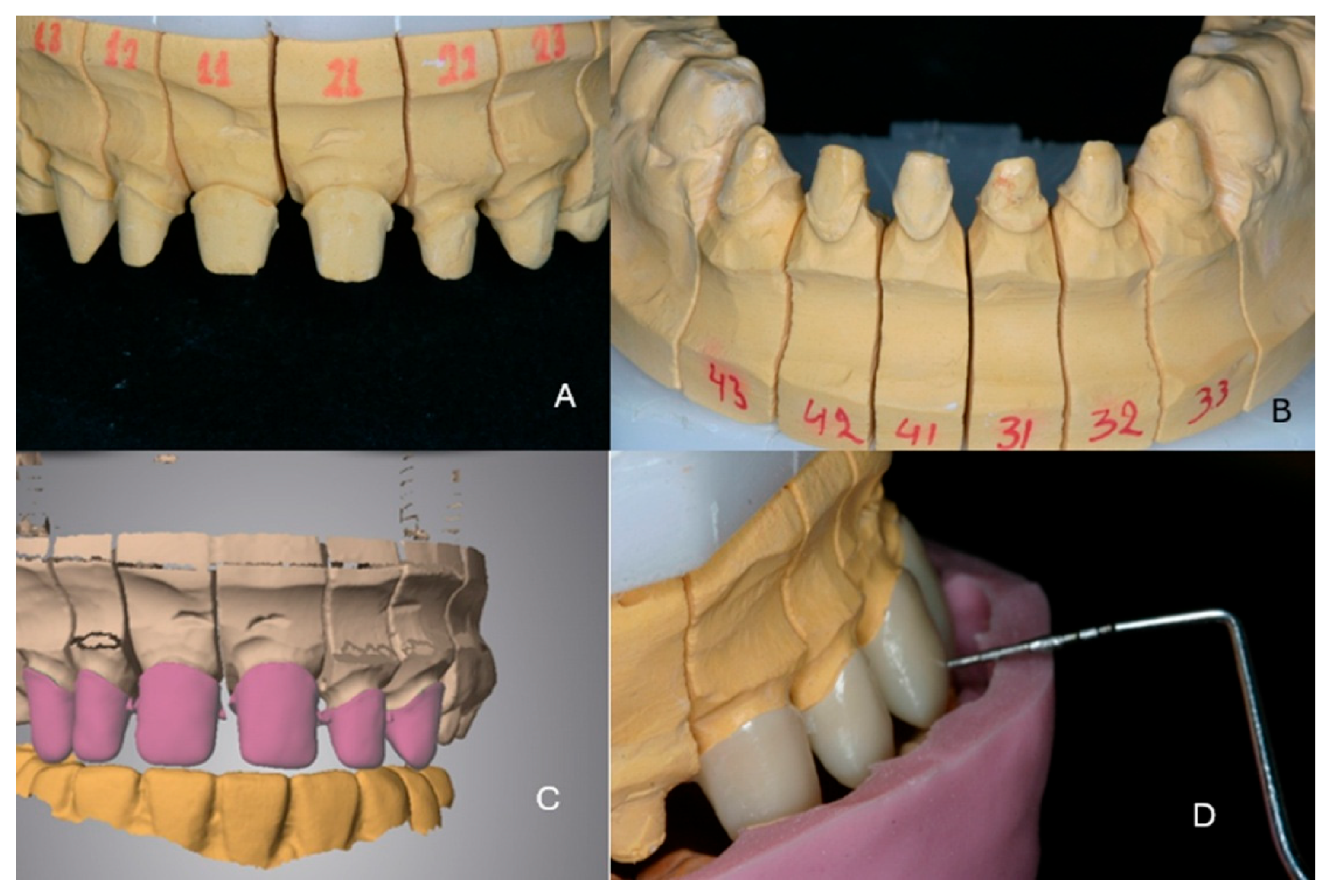 Dentistry 13 00546 g006