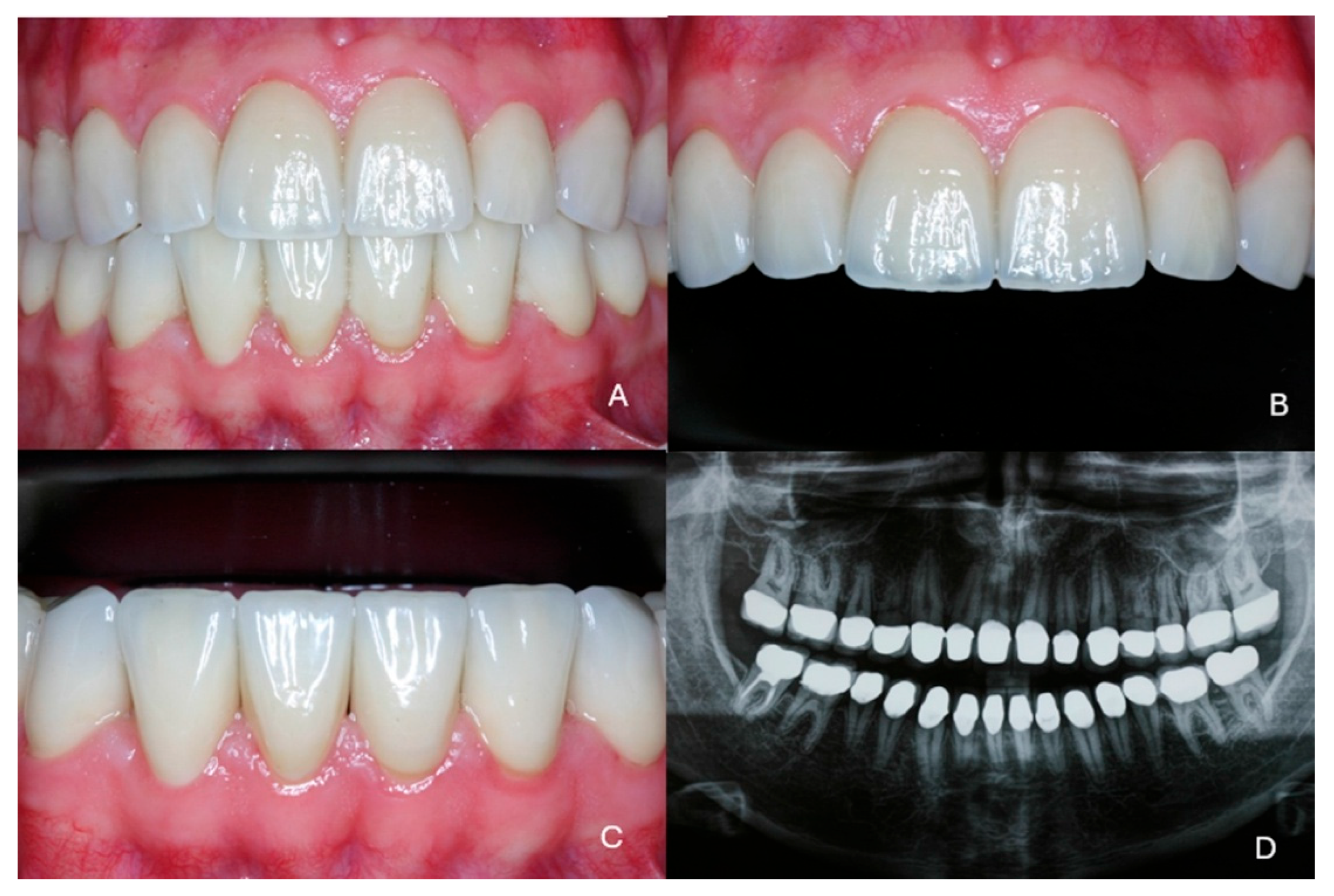 Dentistry 13 00546 g008