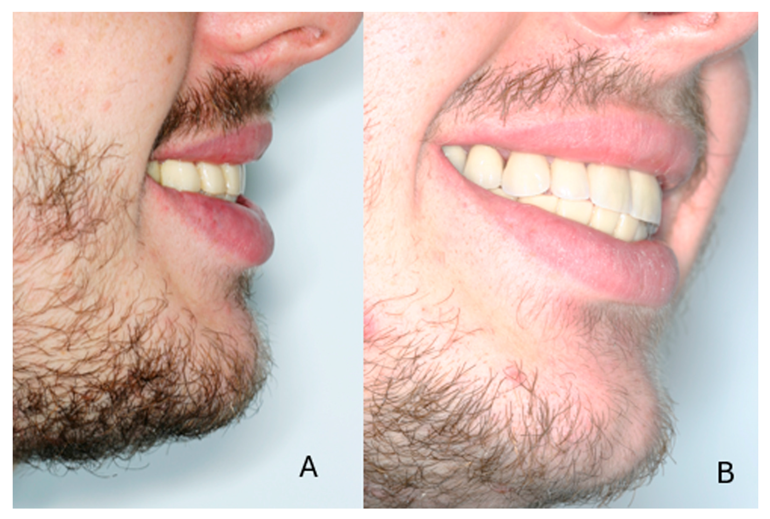 Dentistry 13 00546 g009