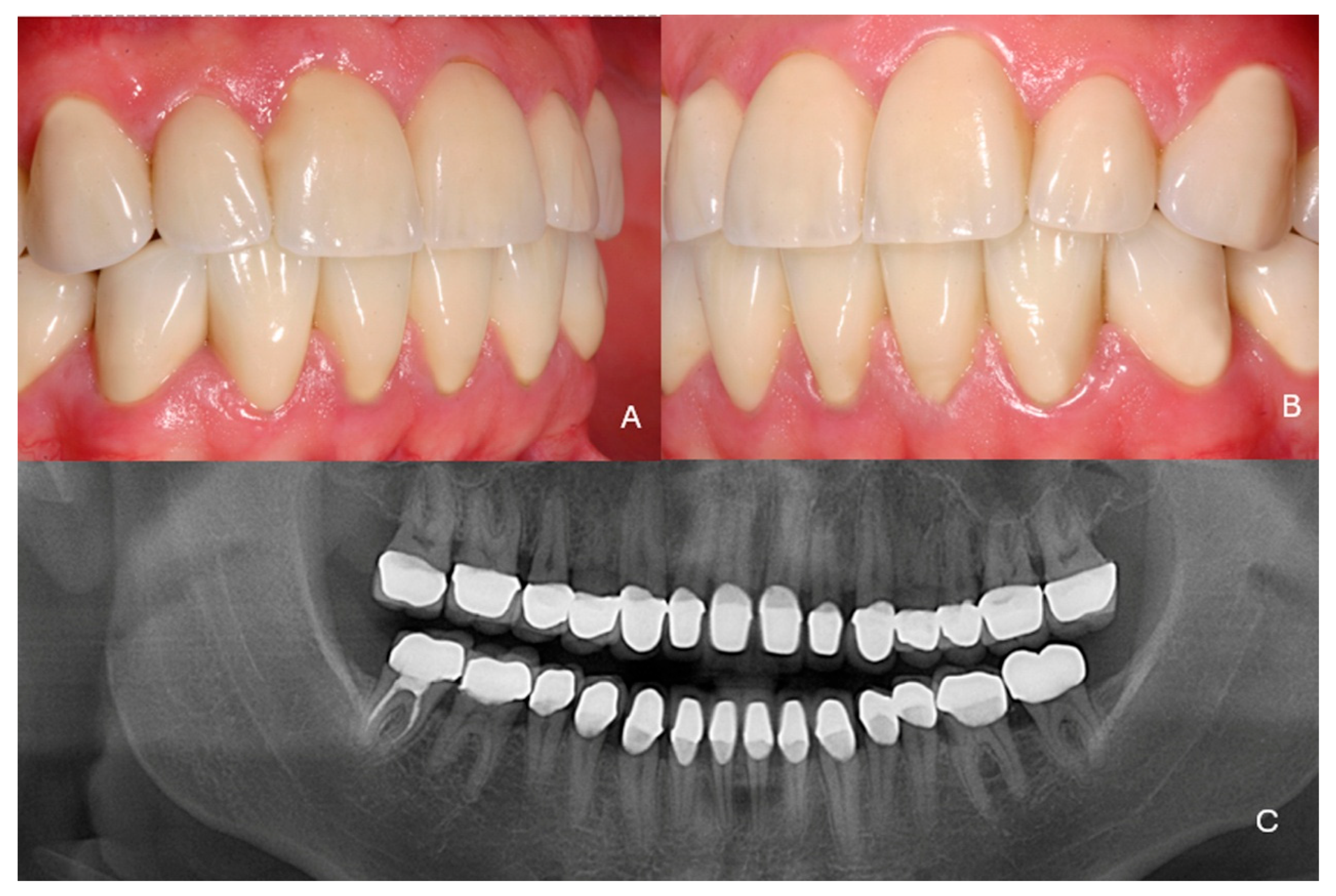 Dentistry 13 00546 g010