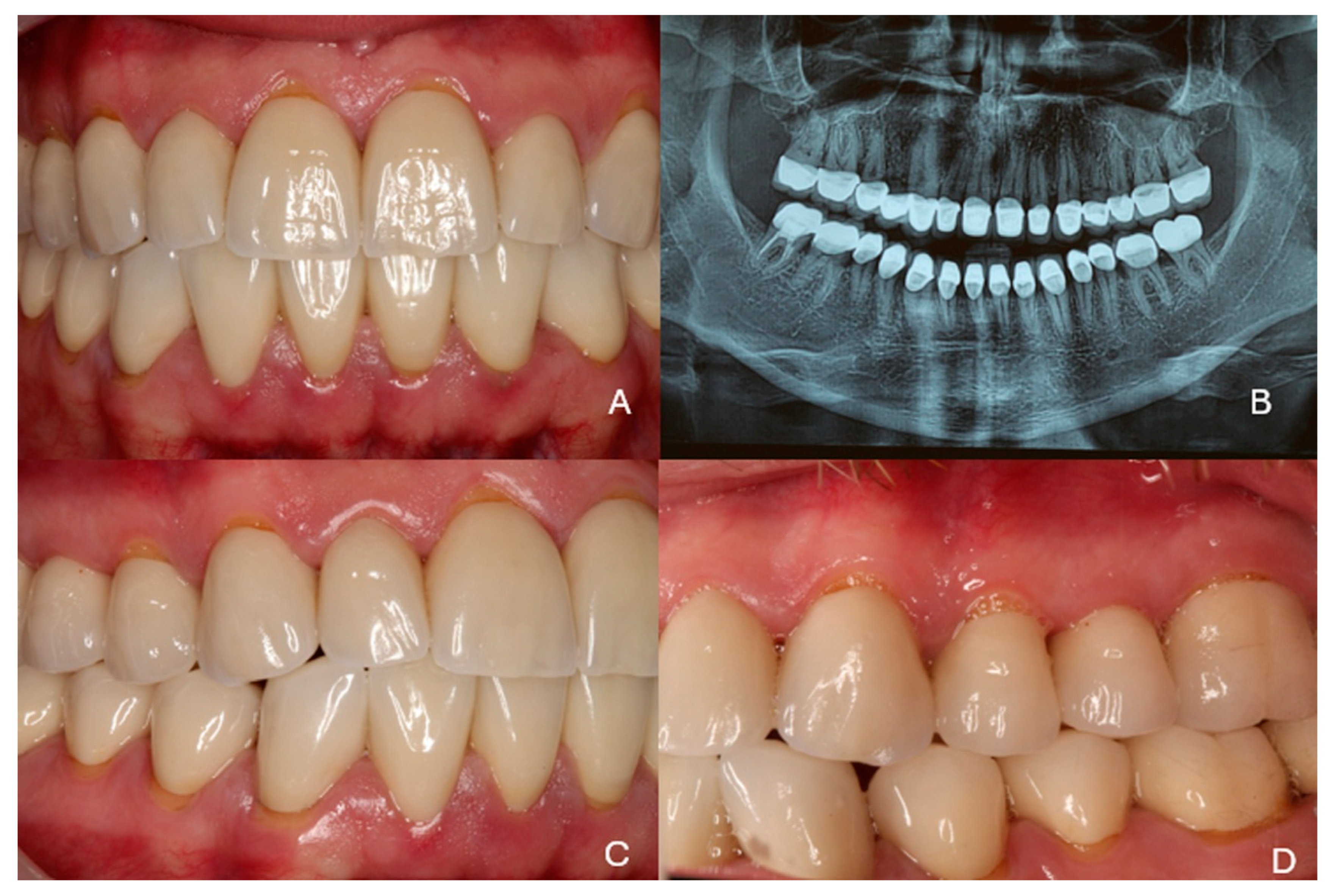 Dentistry 13 00546 g011