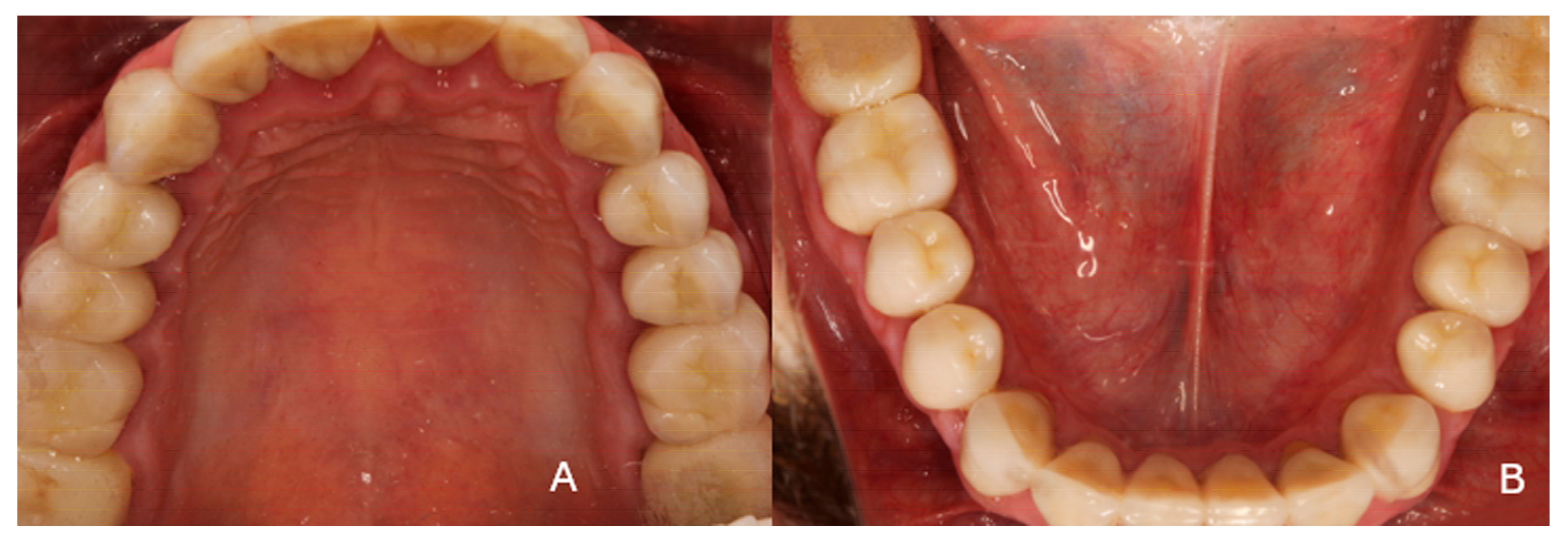 Dentistry 13 00546 g012