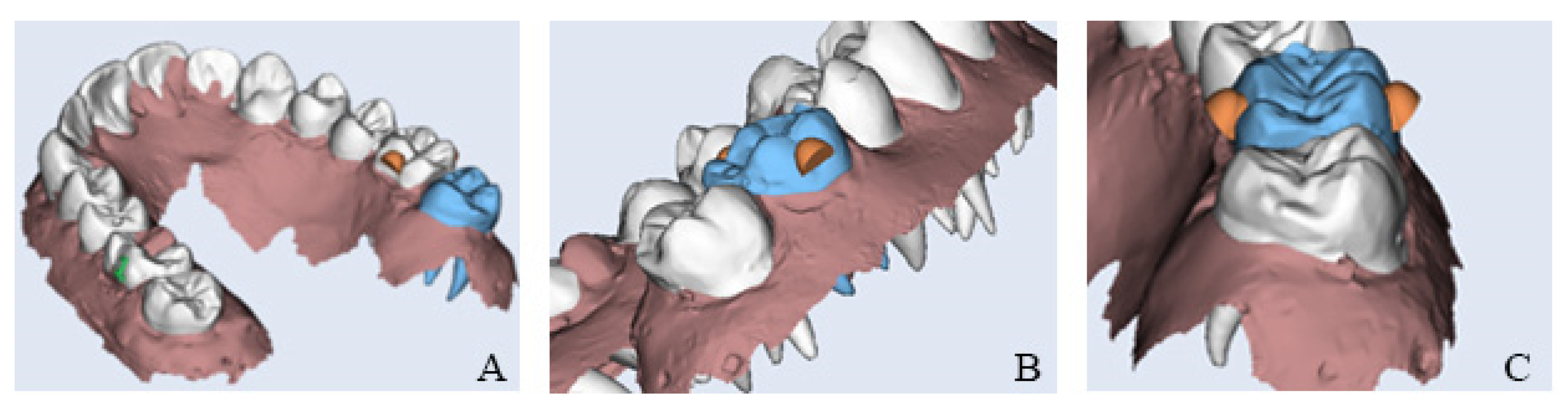 Dentistry 13 00551 g002