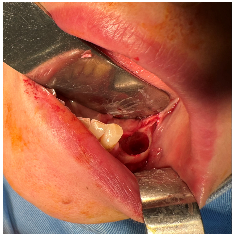 Dentistry 13 00560 g005