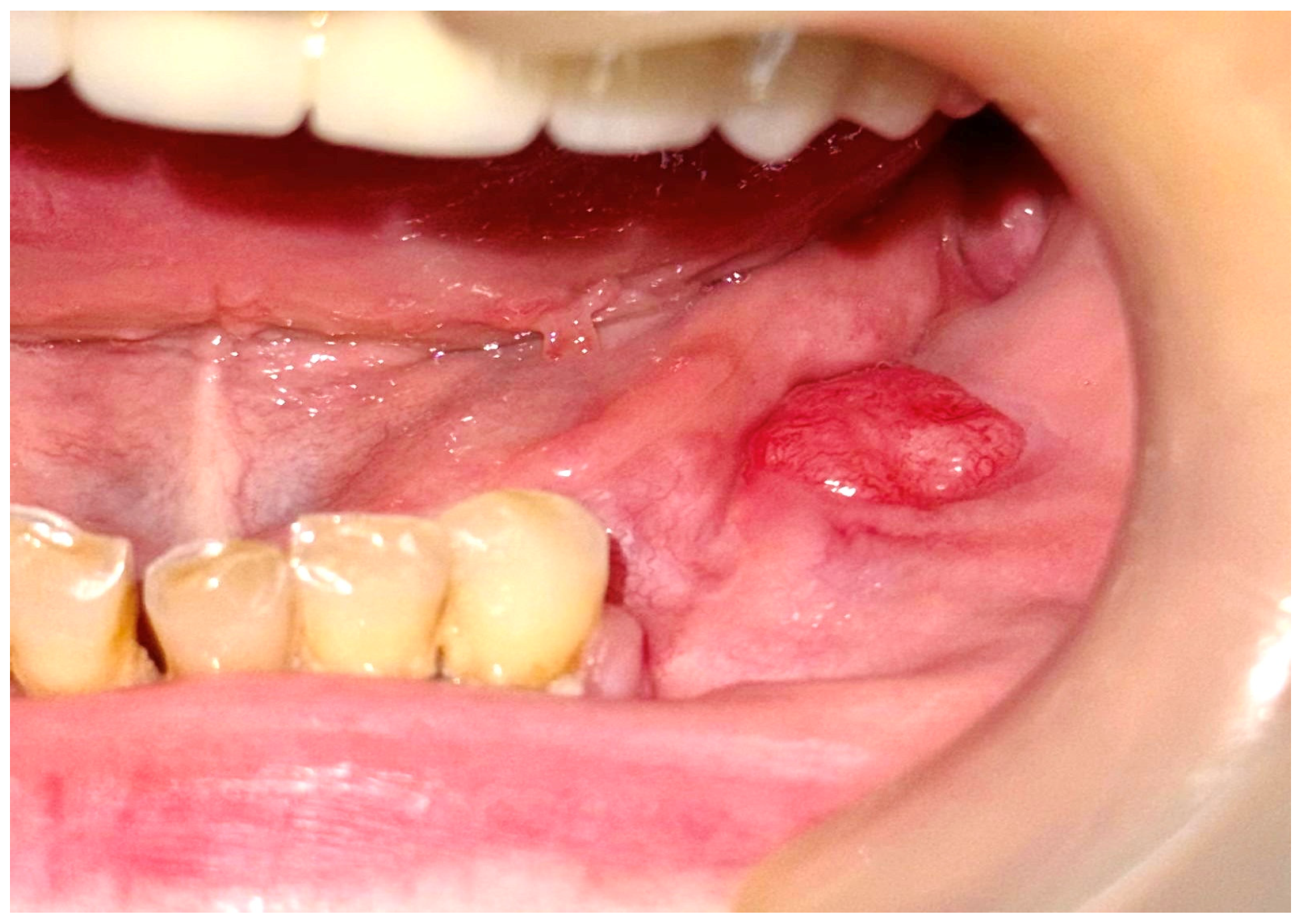 Dentistry 13 00560 g009