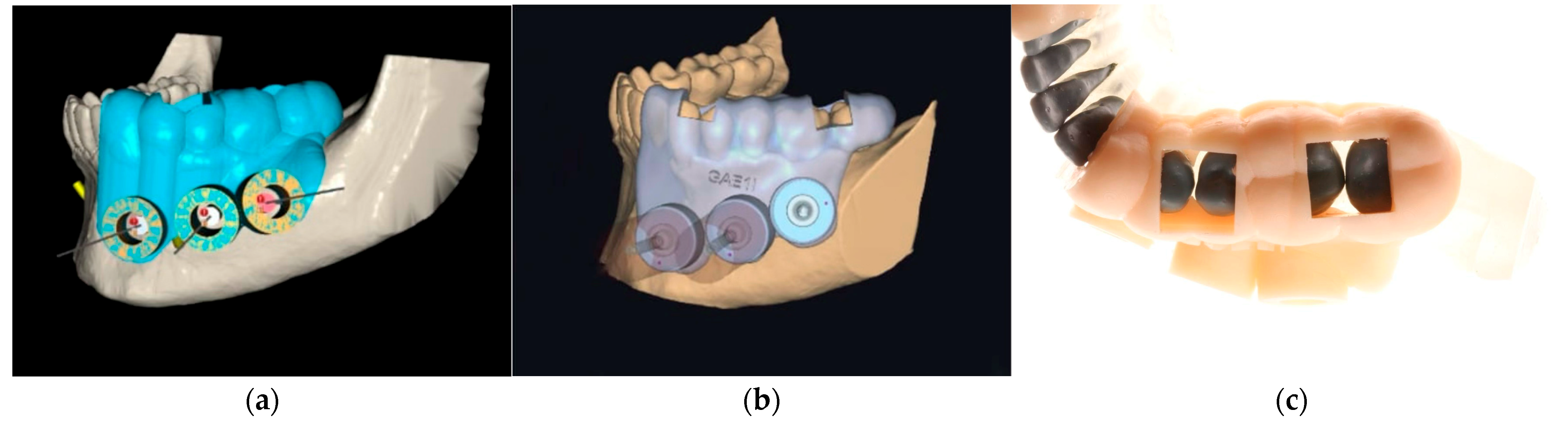 Dentistry 13 00561 g001
