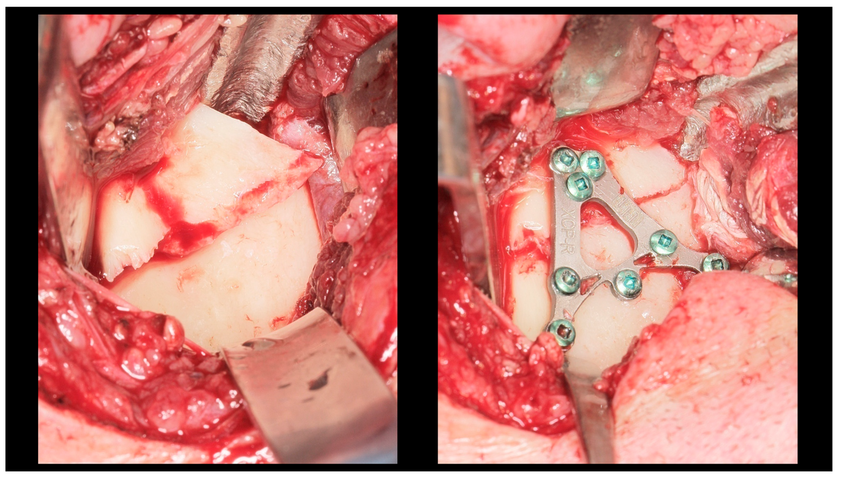 Dentistry 13 00562 g003