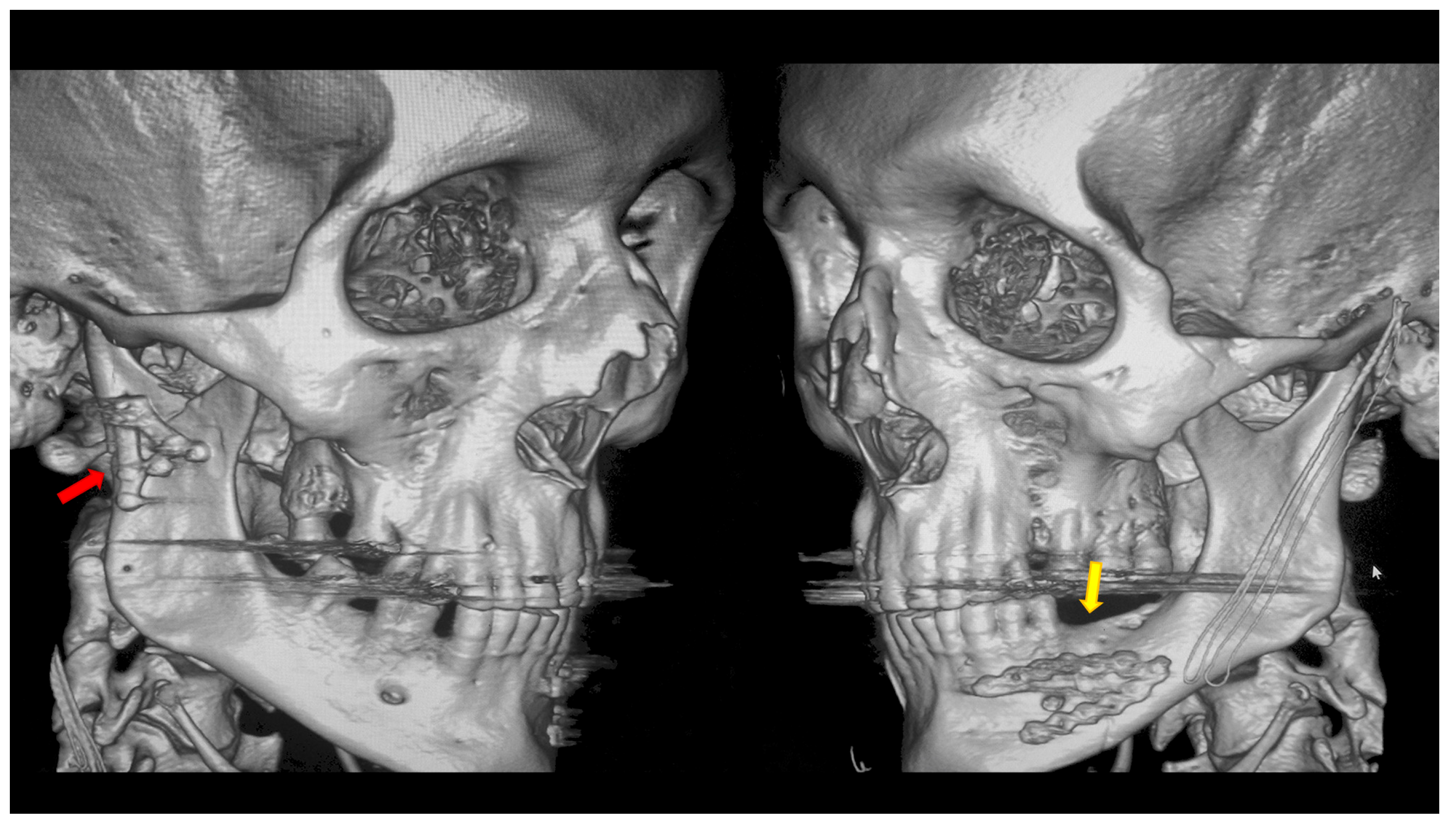 Dentistry 13 00562 g004