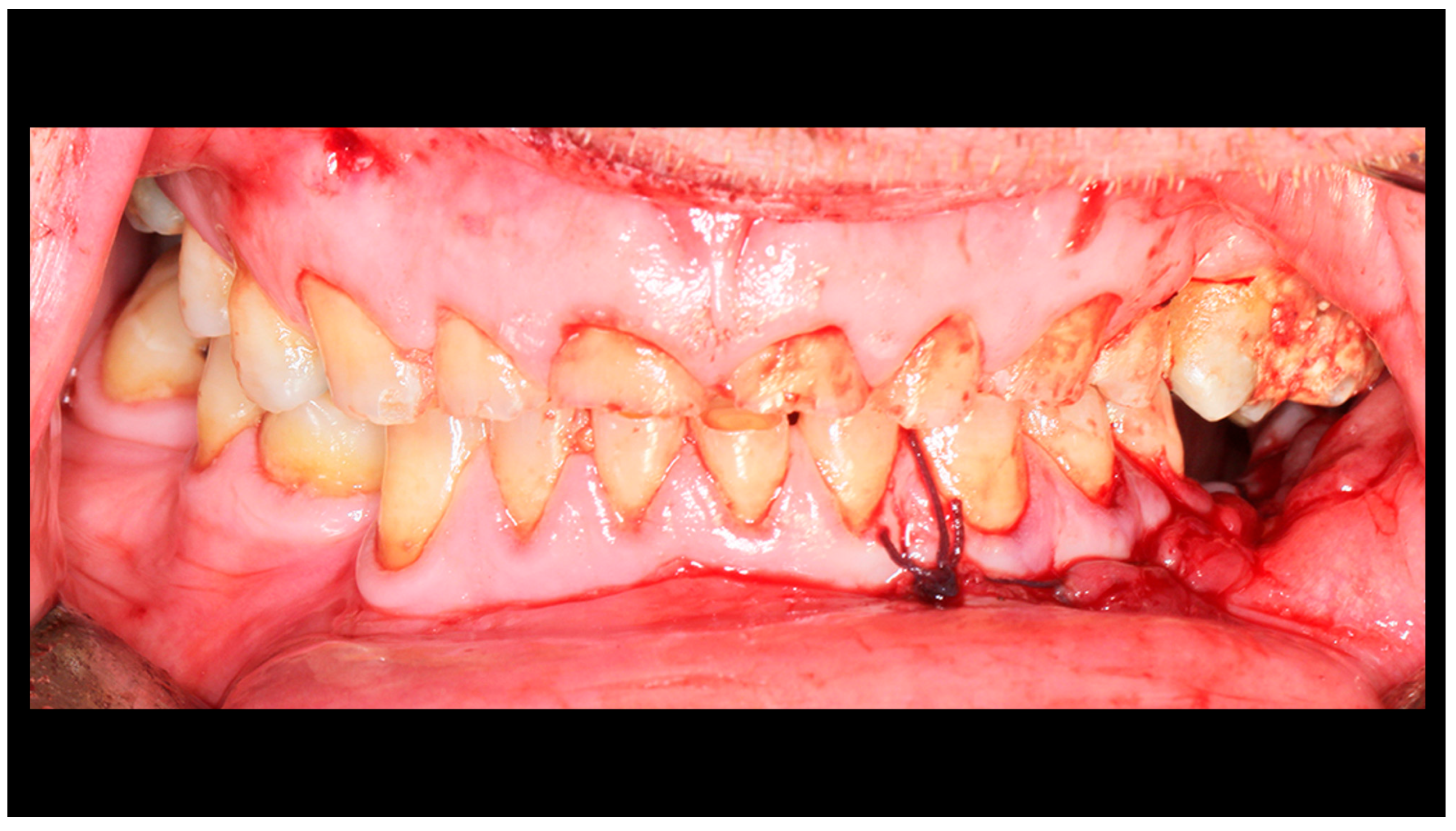 Dentistry 13 00562 g005