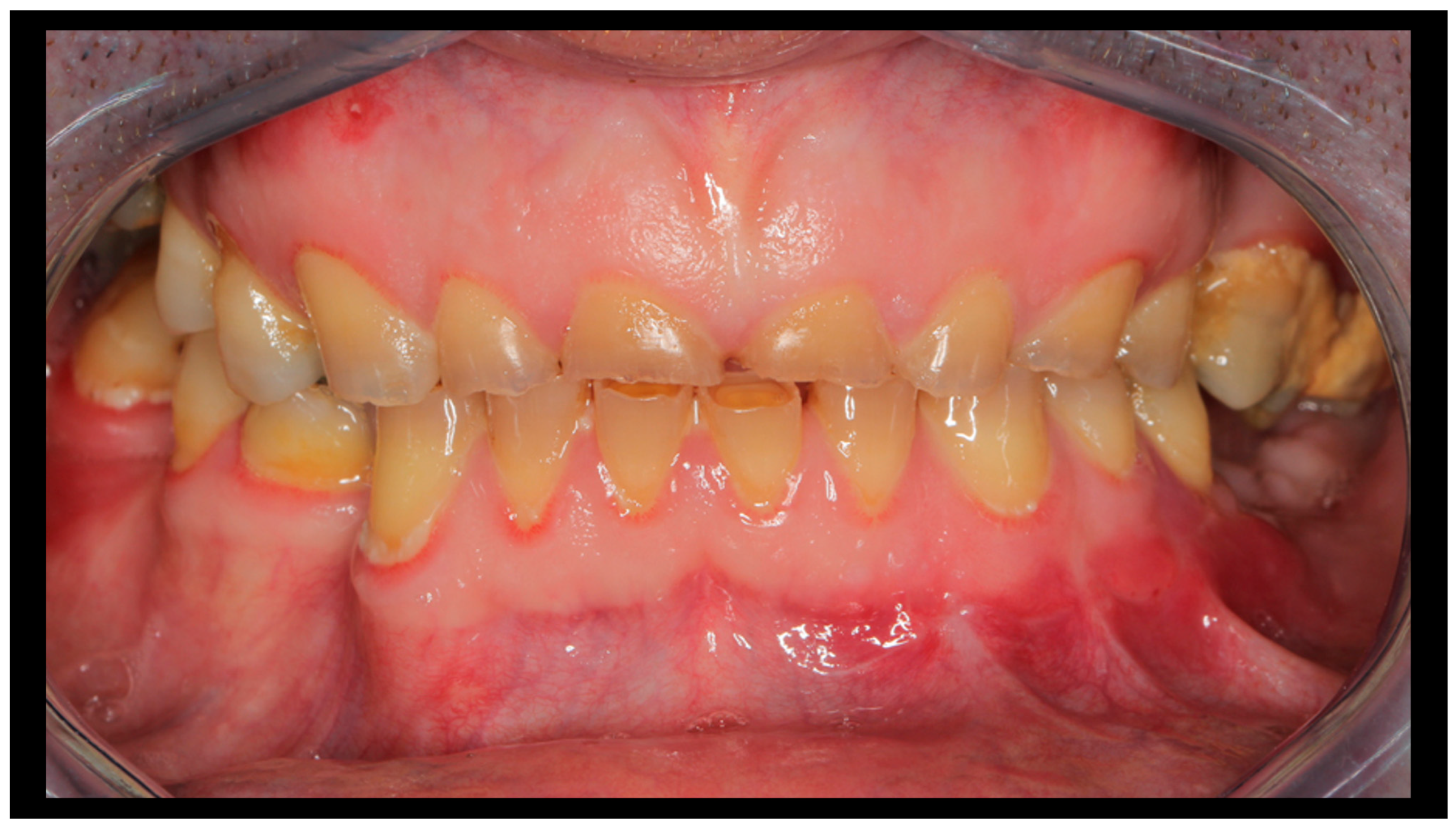 Dentistry 13 00562 g007