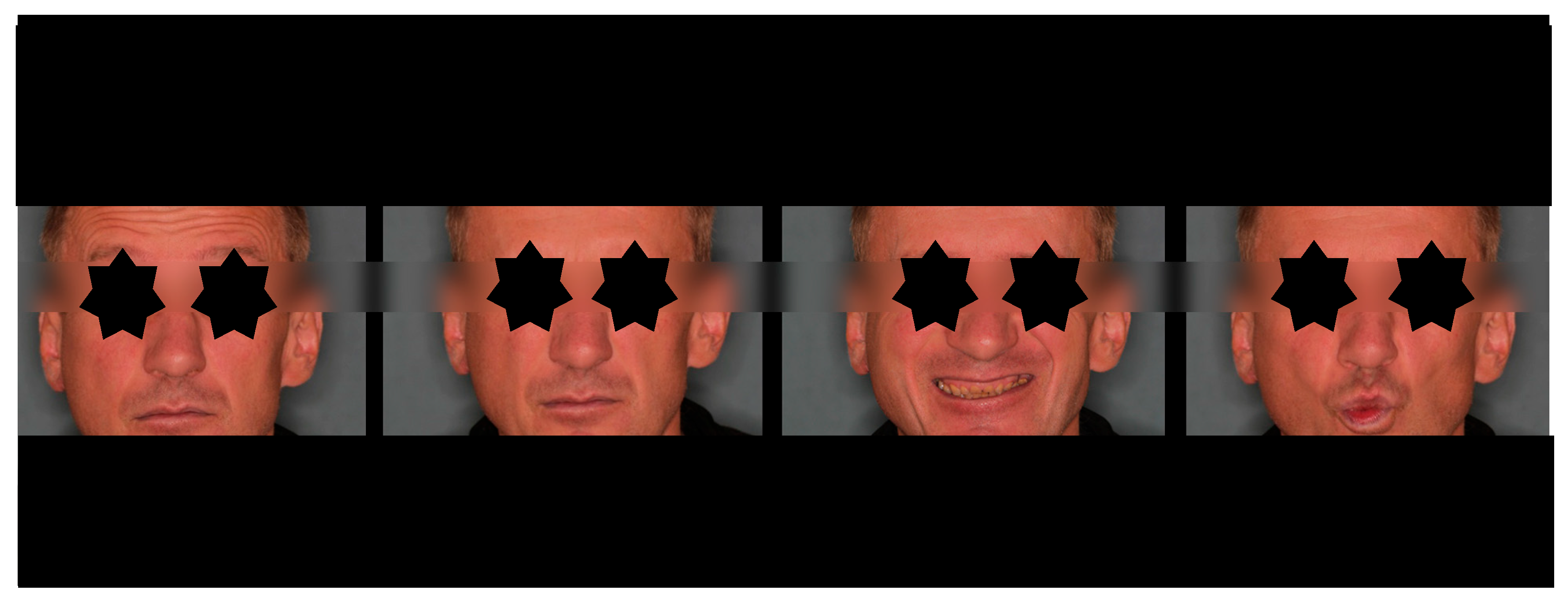 Dentistry 13 00562 g009